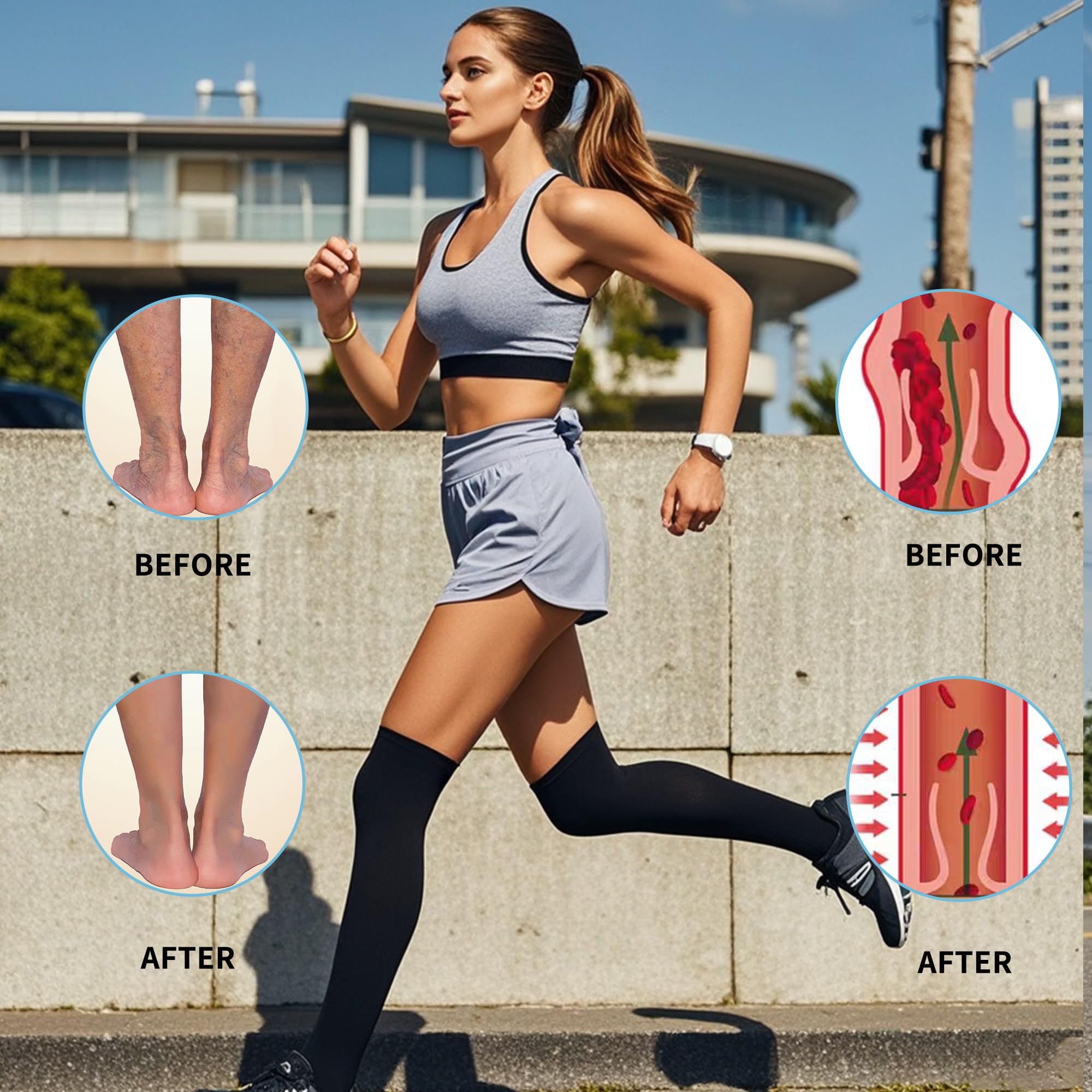 20-30 mmHg Thigh High Compression Stockings for Women & Men - Open Toe with Silicone Dot Band - Perfect for Varicose Veins, Swelling Relief & Long Flights