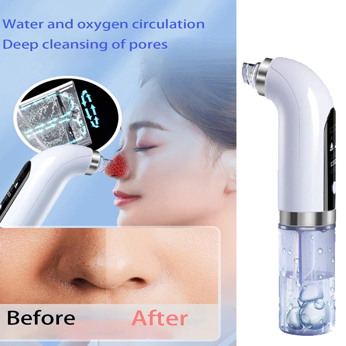 Electric Blackhead Remover Pore Vacuum - Upgraded Facial Pore Cleaner with 3 Suction Power & 6 Probes | USB Rechargeable Acne Comedone Whitehead Extractor Tool for Women & Men | Perfect for Deep Cleansing, Acne Treatment & Skincare Routine