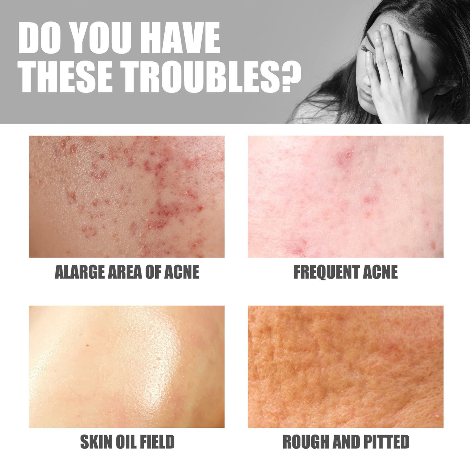 Best Buttock Pimple Treatment Cream - Acne Cleansing & Skin Moisturizing Repair for Thigh & Butt Area | Prevent & Soothe Breakouts for Smooth Skin | Perfect for Post-Workout, Travel & Daily Care