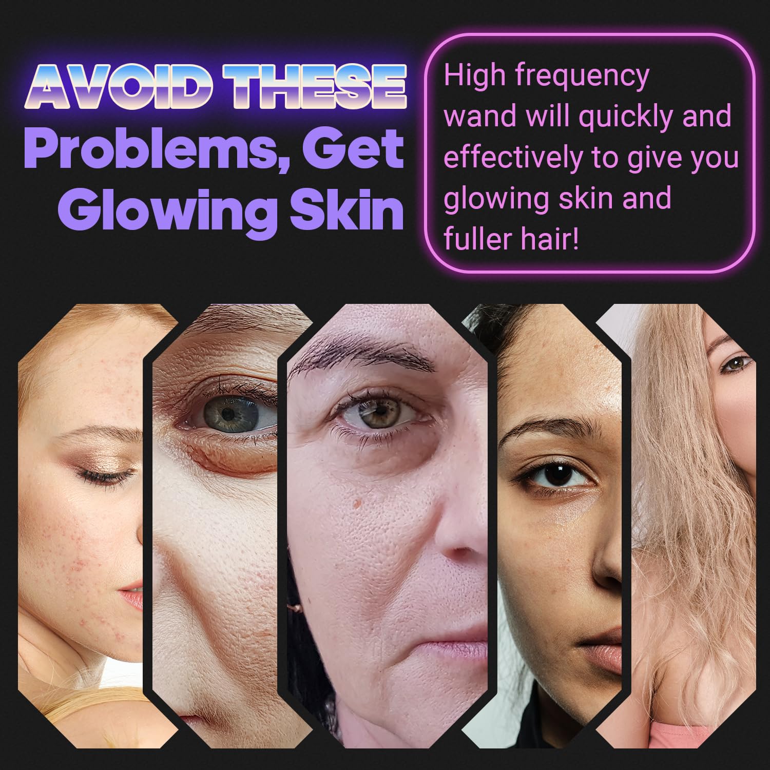 UUPAS High Frequency Light Therapy Wand for Face - Anti-Aging Facial Machine for Acne, Wrinkles & Skin Rejuvenation - At-Home Skincare Device for Spa-Like Treatments