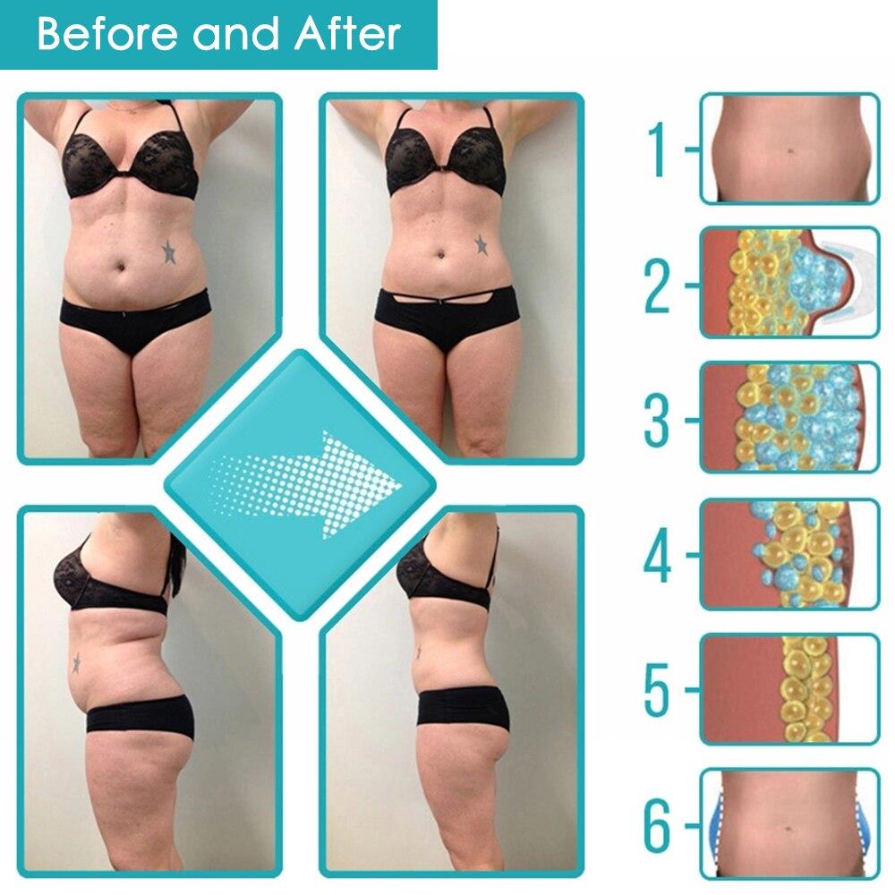 Fat Freezer Cryolipolysis System - Patented Cooling Technology for Body Fat Reduction | Effective for Stubborn Belly, Thigh & Arm Fat | At-Home & Professional Use
