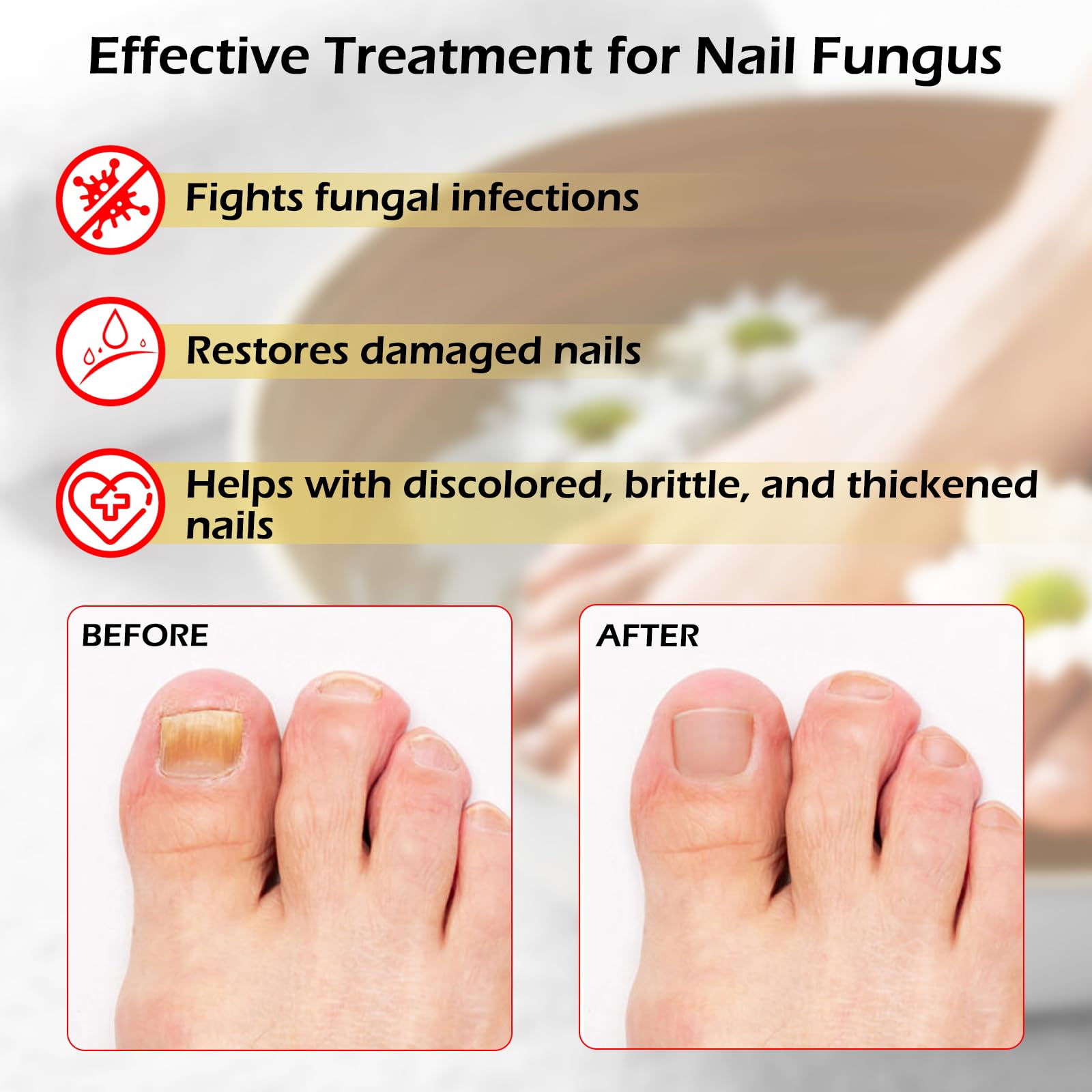 Extra Strength Toenail Fungus Treatment - Fast Acting Tea Tree Oil Formula for Fungal Nail Repair, Cracked & Discolored Nails - 30ML Nail Growth Strengthener | Effective for Athlete's Foot & Daily Nail Care