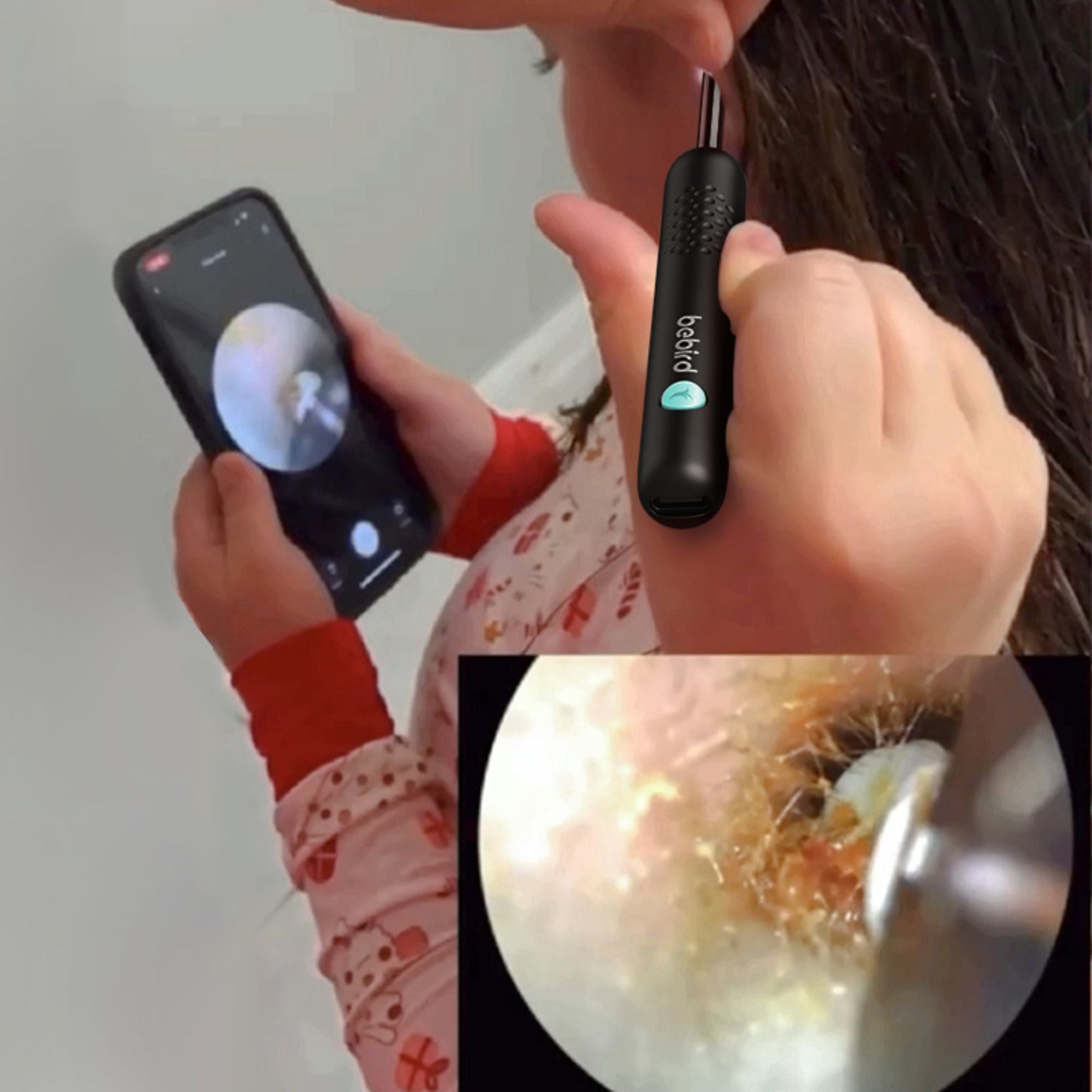 Bebird R1 PLUS Smart Ear Wax Removal Tool - Electric Ear Cleaner with Camera, LED Light & Safe Earwax Remover for Adults & Kids - Perfect for Home Use, Travel & Personal Hygiene Care