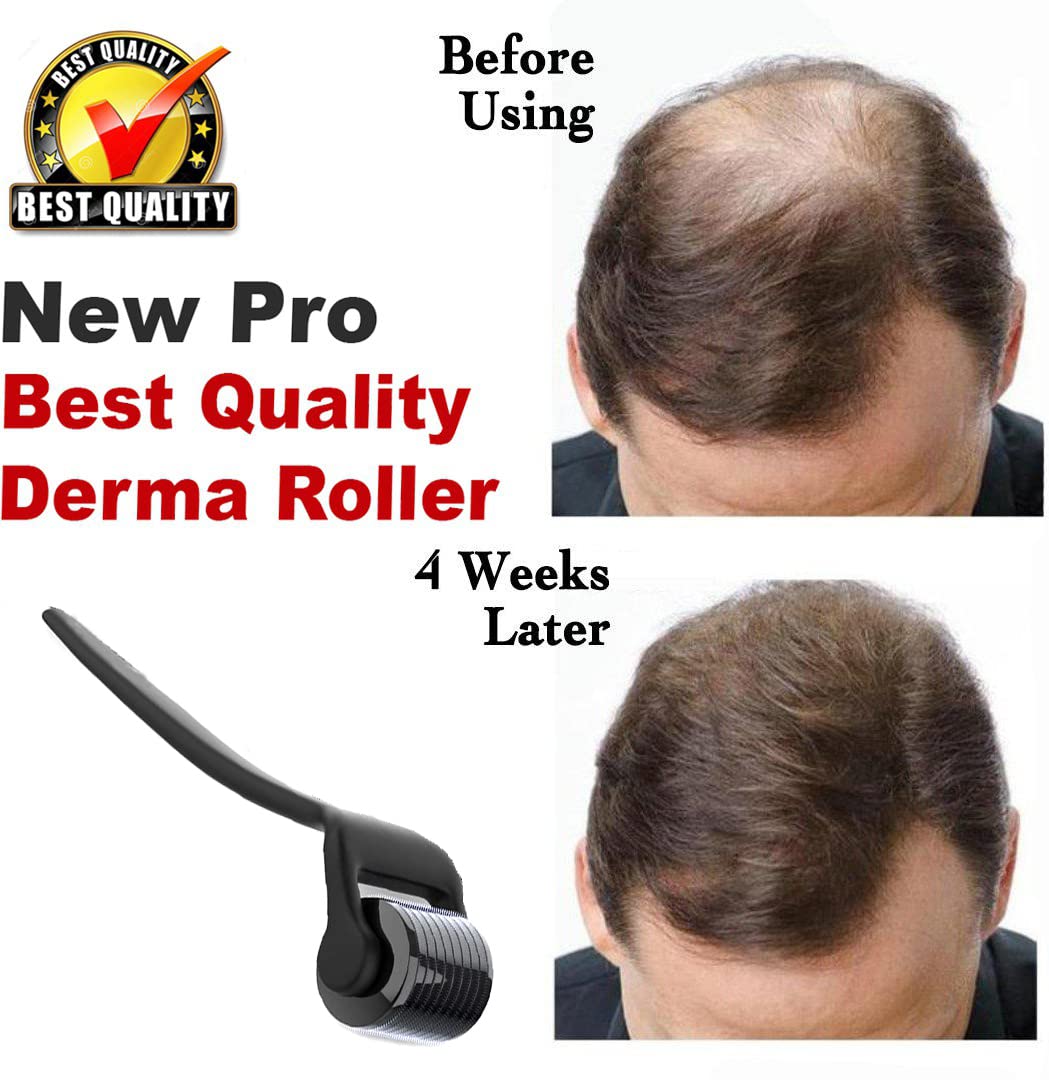 540 Titanium Alloy Micro Needle Roller 0.5mm for Hair Growth - Reduce Hair Loss & Stimulate Follicles - Safe Effective Derma Roller for Beard & Scalp Care - At-Home Hair Regrowth Treatment
