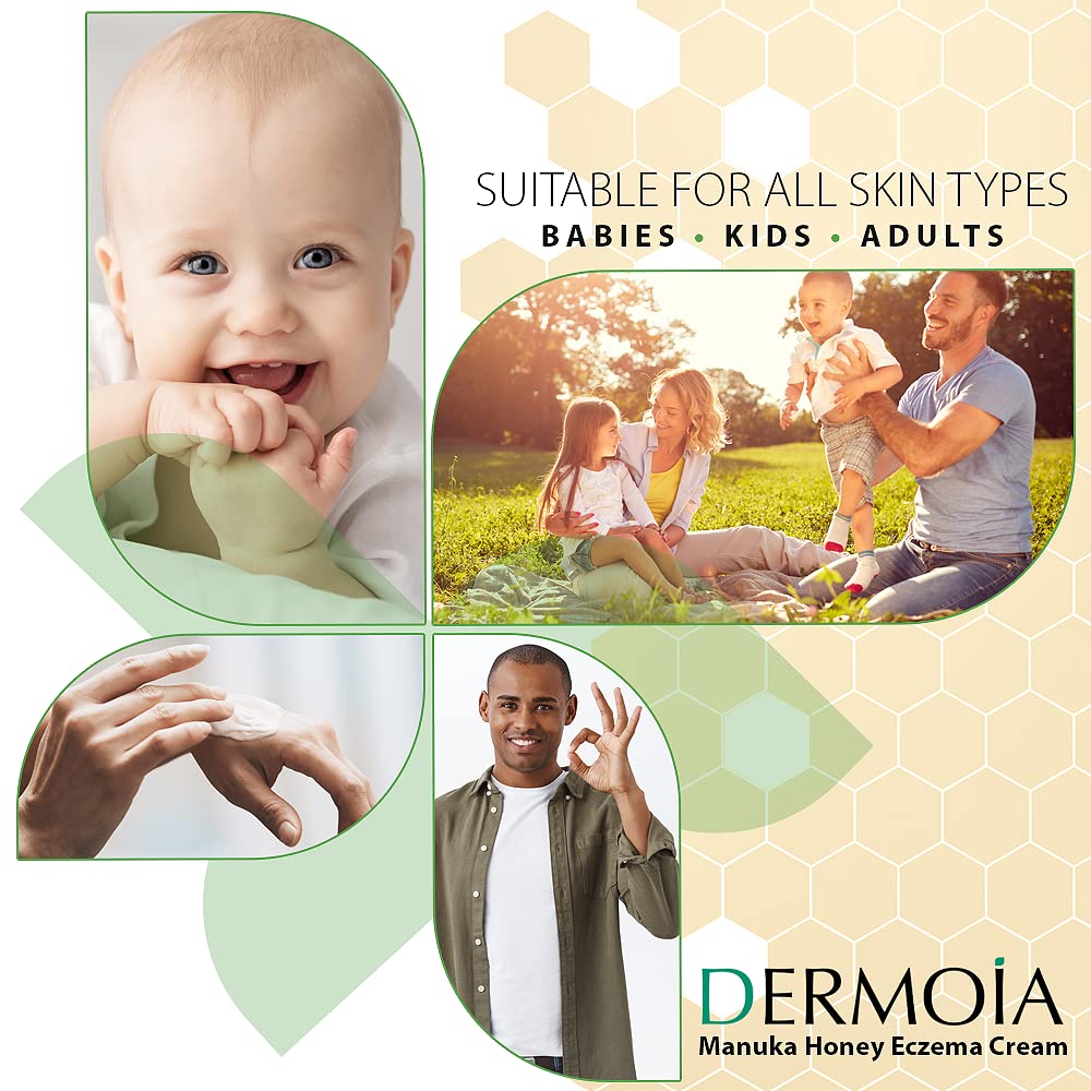 Manuka Honey Cream for Eczema & Dermatitis Relief - 4oz - Soothes Itchy Skin for Adults & Kids