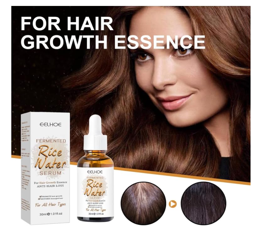 HERBALIX LuxuryHerbs Rice Water Serum for Hair Growth - 30ml Hair Growth Treatment for Thinning Hair & Hair Loss in Women & Men | Strengthens & Nourishes Hair for Daily Use at Home or Salon