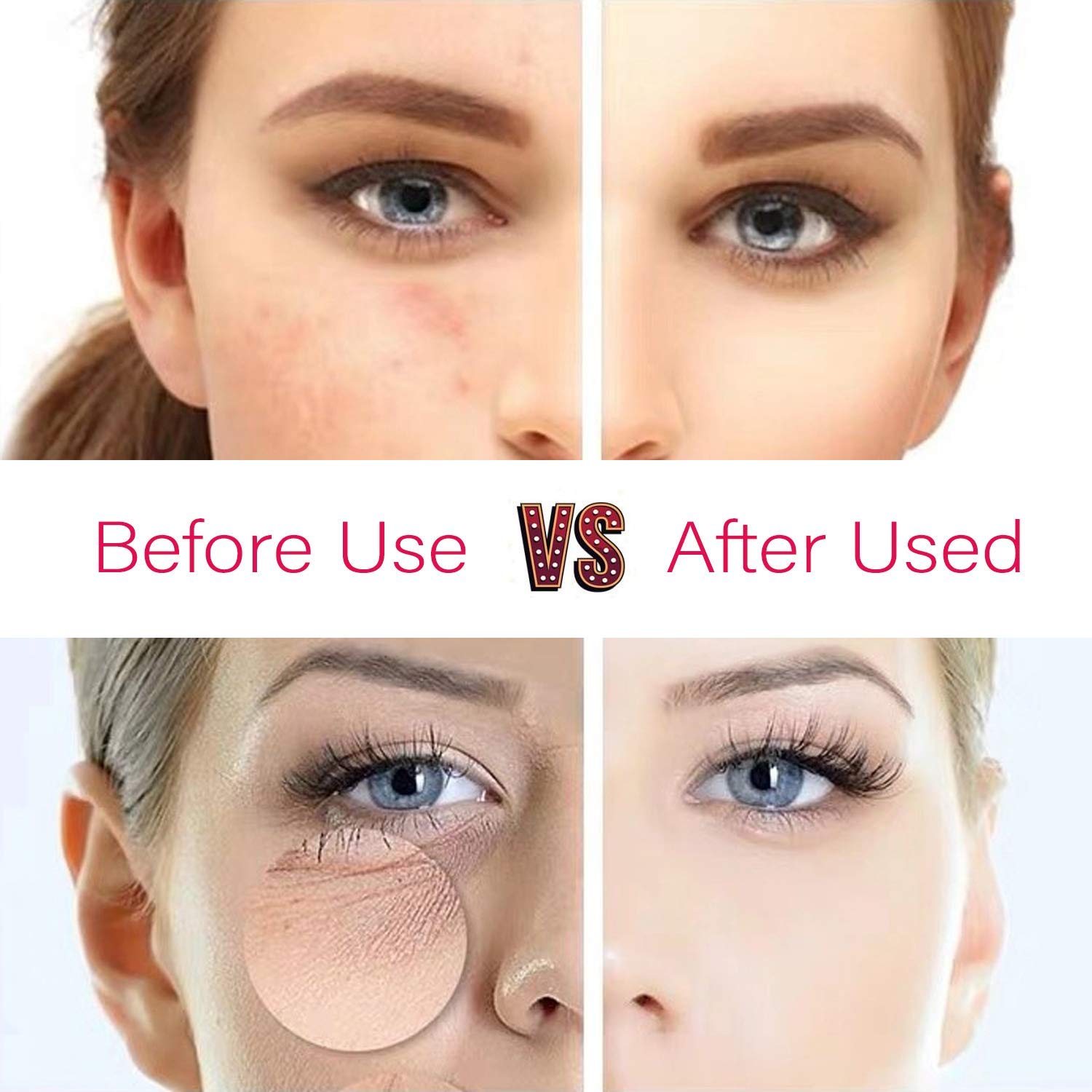 7-Color LED Face Mask for Acne & Skin Therapy - Photon Light Therapy Mask with Proven Results (White) | At-Home Facial Treatment & Anti-Aging Skincare