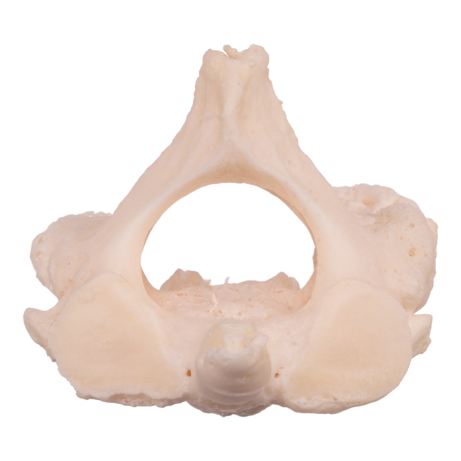 High-Quality Real Research Human Cervical & Axis Vertebrae Fused Specimen - Perfect for Medical Studies, Anatomy Education, and Surgical Training