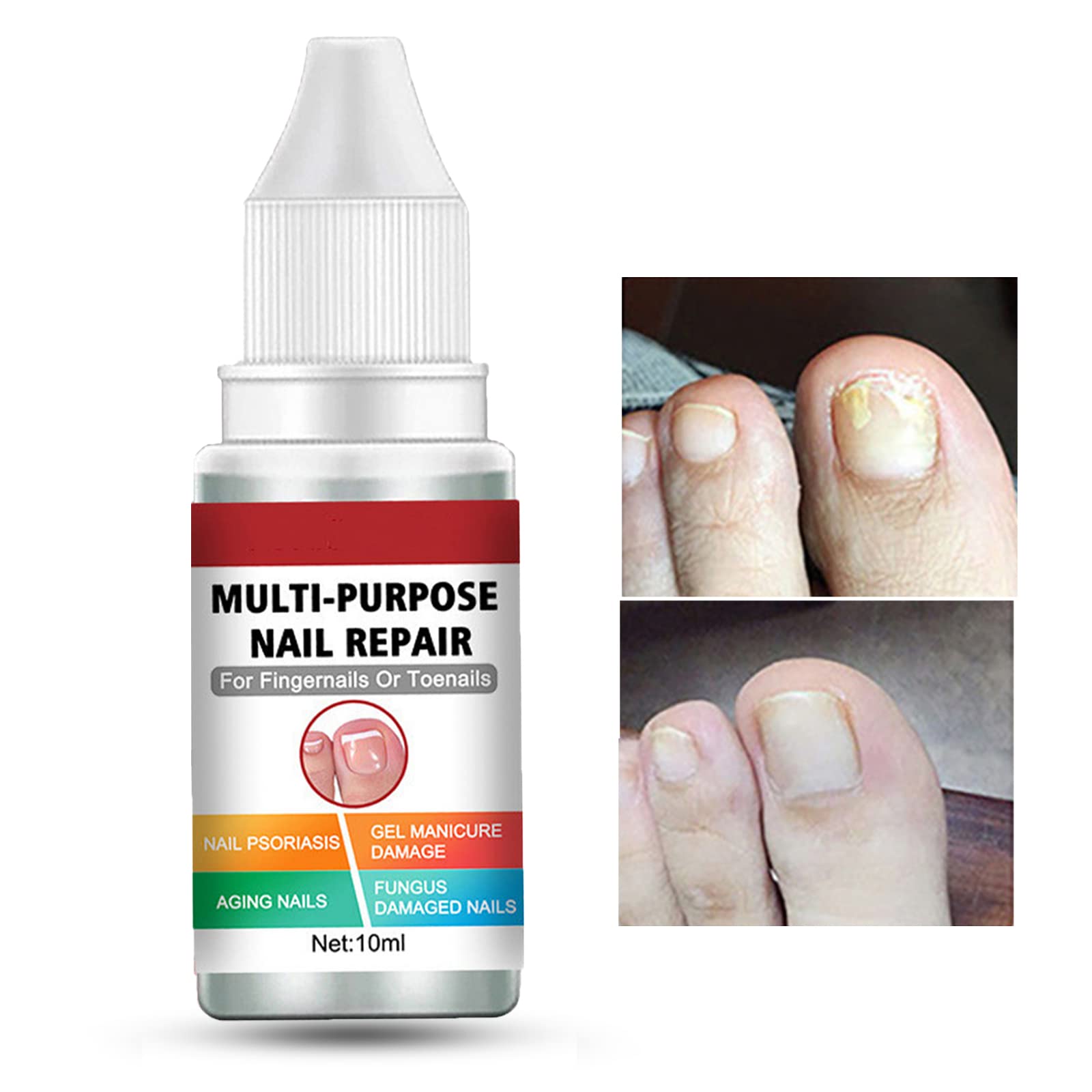 Extra Strong Fungal Nail Treatment for Toenails & Fingernails | Safe & Effective Nail Repair Lotion | Fixes Discolored & Damaged Nails | Multi-Purpose Antifungal Solution (10ML, Red) | Perfect for Athletes, Swimmers & Daily Foot Care
