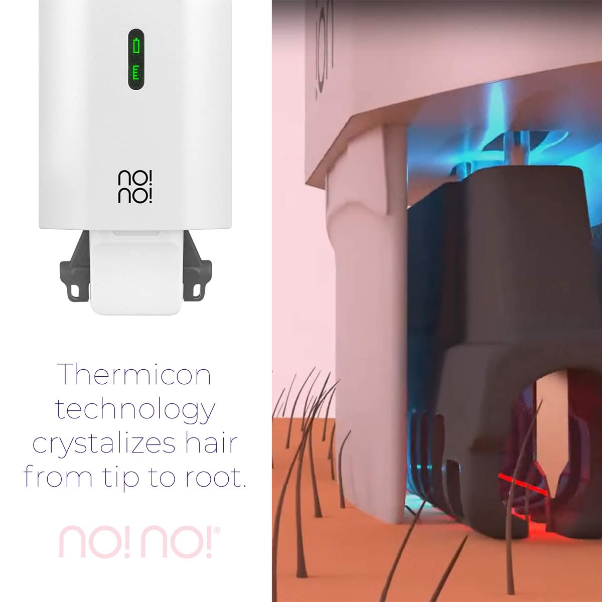 No!No! Micro Hair Removal Device - Rechargeable & Portable for All Skin Tones, Facial & Body Hair Removal for Women & Men - White | Painless Hair Removal at Home, Travel & Gym
