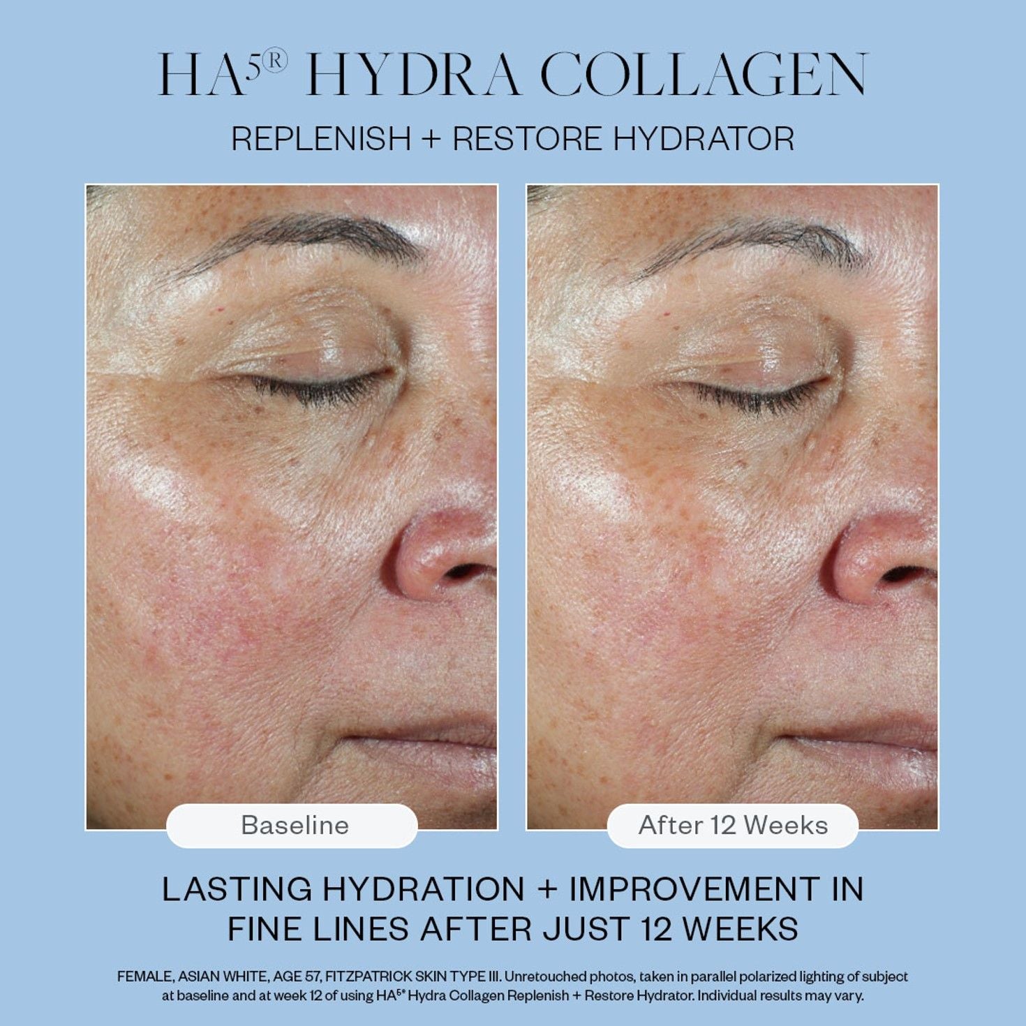 HA⁵ Hydra Collagen Replenish + Restore Hydrator - Anti-Aging Face Moisturizer for Dry Skin | Hydrating & Plumping Serum | Perfect for Night Routine & Daily Skincare