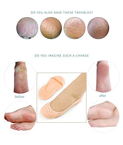 R A Products Anti Crack Full Length Silicone Foot Protector Moisturizing Socks for Dry Cracked Feet & Heel Pain Relief - Best for Overnight Foot Care, Diabetic Foot Therapy & Cracked Heel Treatment (Full Length)