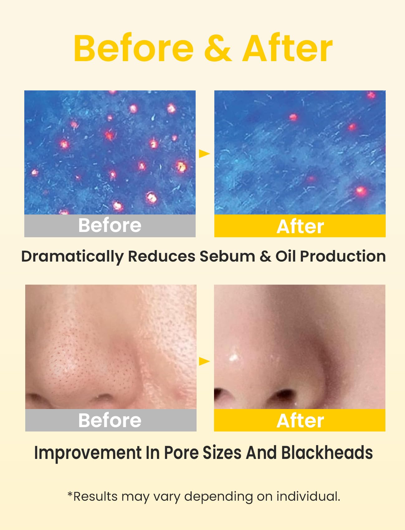 Elvira Pore Control Cleansing Oil & Bio-Collagen Face Mask Set - Korean Skincare for Sensitive Skin | Makeup Remover, Blackhead Removal, Firming & Hydrating Treatment | 4 Sheet Masks Bundle - Perfect for Night Routine, Spa Day & Travel Skincare