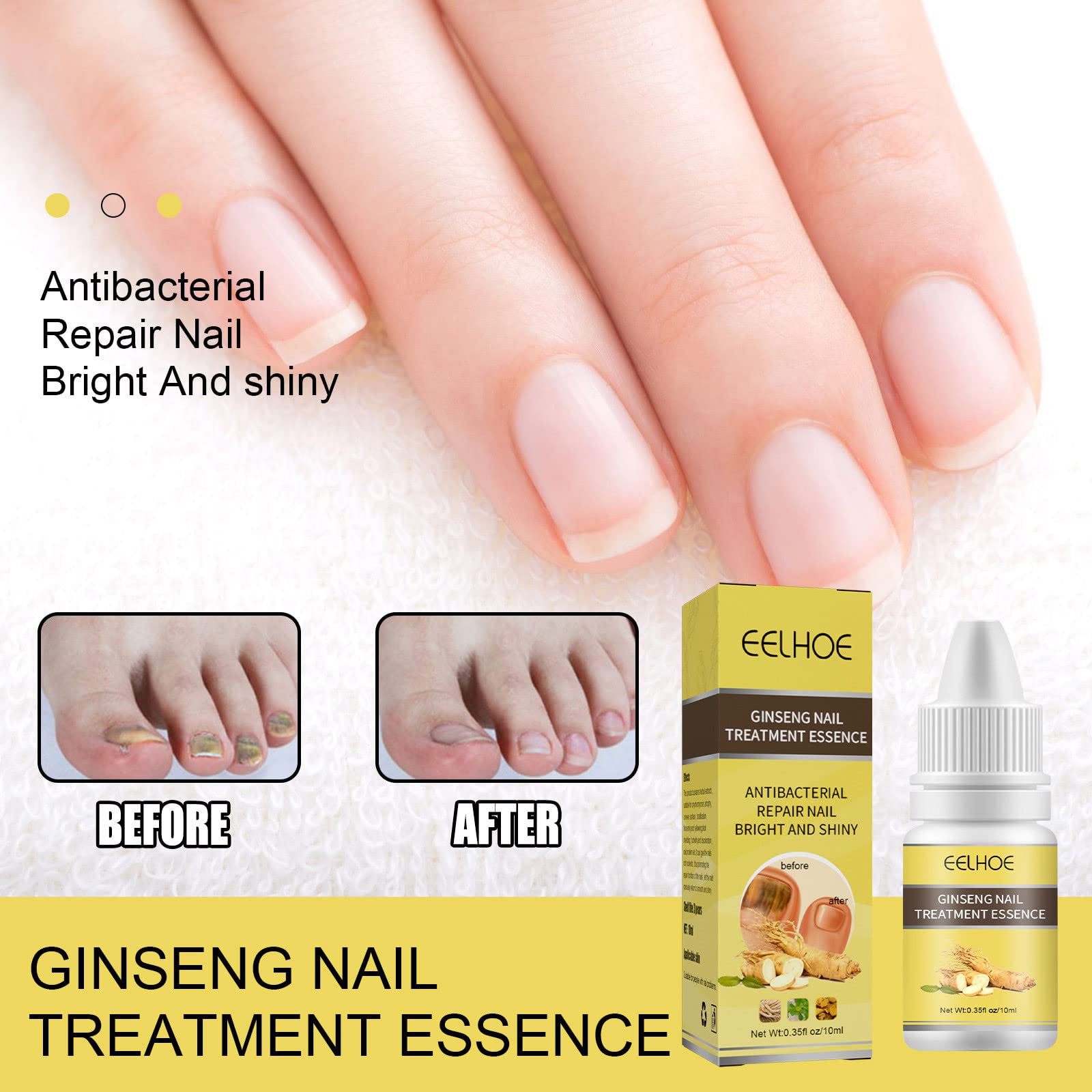 10ml Ginseng Nail Treatment - Herbal Hand & Foot Whitening Cream for Cracked, Rough, Brittle Nails - Natural Nail Care Solution for Toe & Finger Nails - Perfect for Pedicures, Manicures & At-Home Nail Care Routines