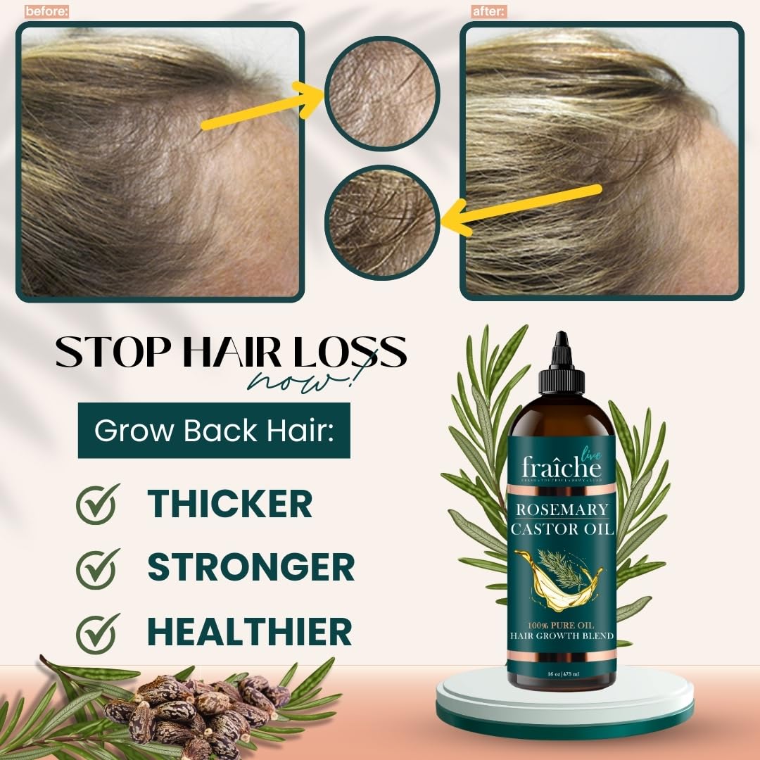 Pure Rosemary Castor Oil for Hair Growth & Thickening - 16oz Natural Hair Care Treatment to Reduce Hair Loss & Promote Healthy Scalp | Perfect for Daily Scalp Massage & DIY Hair Growth Serums