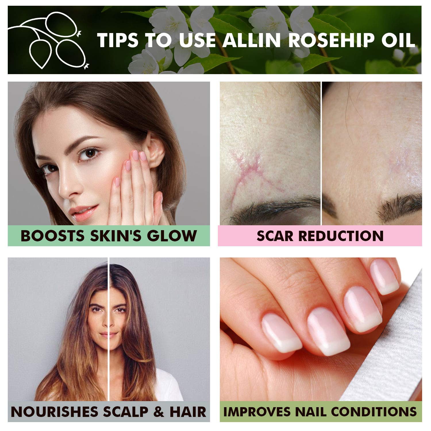 **Organic Rosehip Carrier Oil - 100% Pure, Cold Pressed for Skin Moisturizing, Hair Care & Massage | 15ml | Natural Anti-Aging & Scar Treatment | Perfect for DIY Beauty & Aromatherapy**