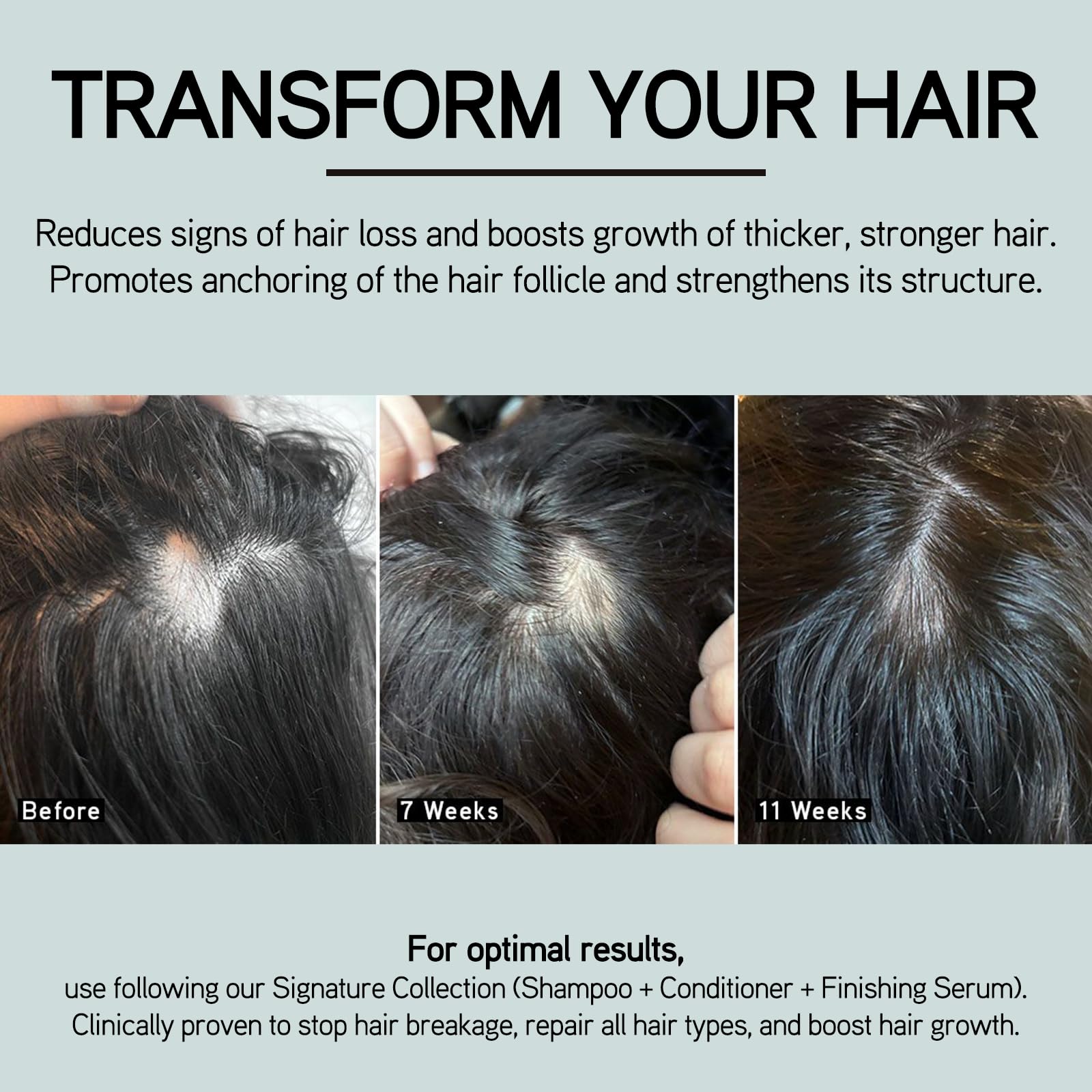 ILES FORMULA Haute Performance Shampoo & Conditioner Set with Scalp & Hair Rejuvenating Booster - Deep Cleansing, Detangling, Stops Breakage, Reduces Hair Loss & Promotes Growth | For Damaged, Dry Hair & Scalp Care at Home or Salon