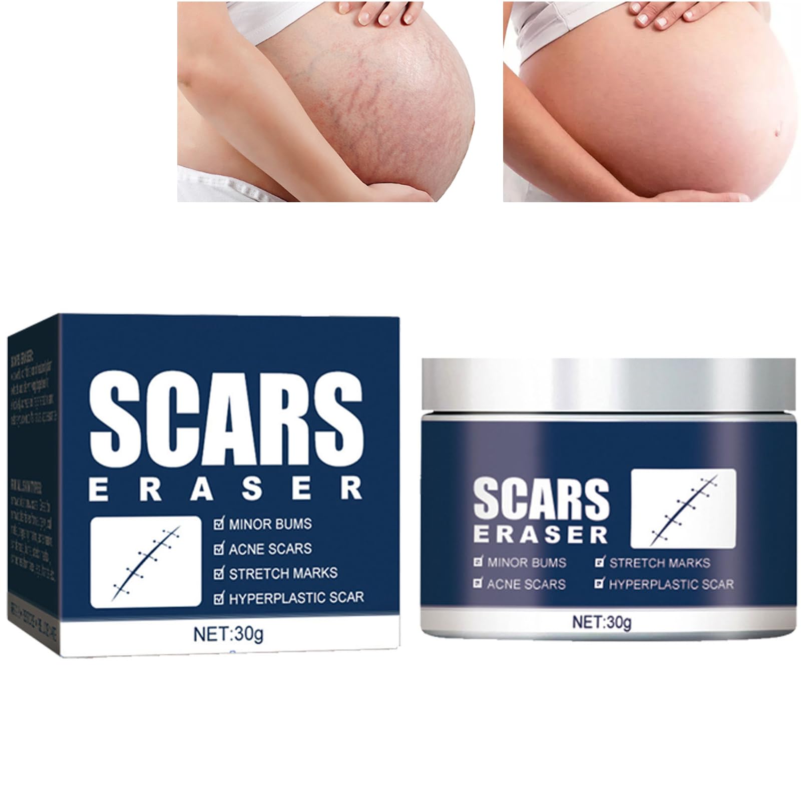 Premium Scar Repair Cream for Face & Body - Medical Grade Scar Removal Treatment for Surgery, Acne, Burns & Injuries - Post-Op Healing Ointment for Smooth Skin Recovery - Ideal for Daily Use After Wounds & Cosmetic Procedures