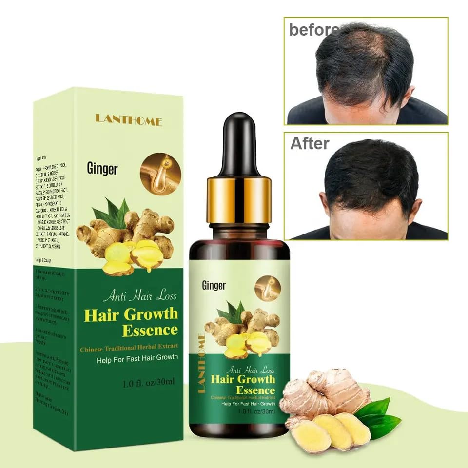 Ginger Germinal Oil for Hair Growth - Natural Hair Growth Serum for Women & Men - Thicker, Stronger, Longer Hair Treatment - 30ml Bottle - Ideal for Thinning Hair & Scalp Care - Perfect for Daily Hair Regimen & Styling