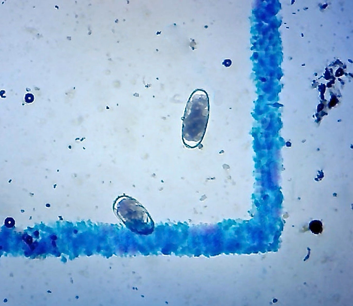 McMaster Method Microscope Slide for FEC (Fecal Egg Count) & Worm Testing - Double Chamber Parasite Detection Kit for Horses, Sheep, Goats, Cattle | Veterinary & Livestock Health Management Tool