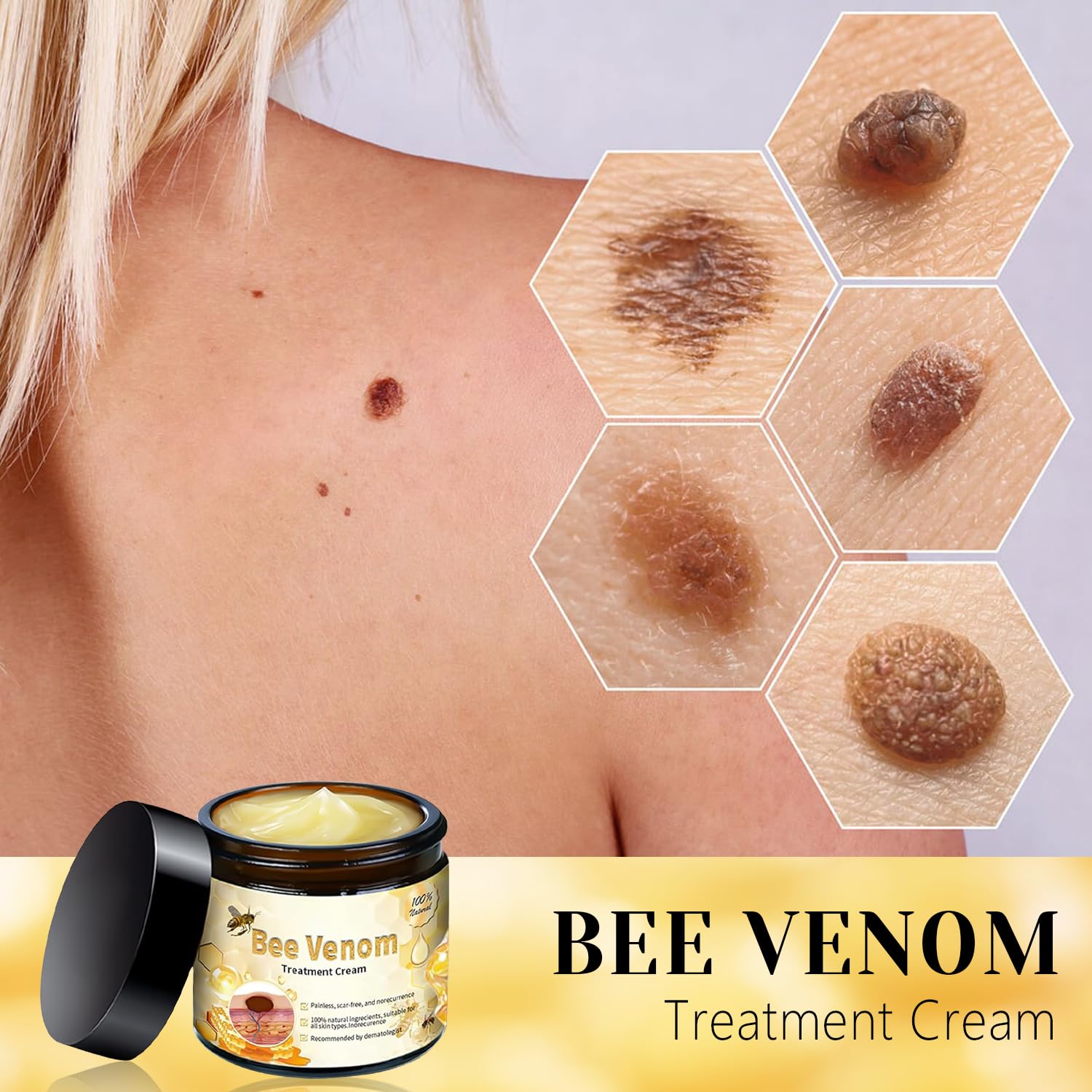 2025 New Bee Venom Treatment Cream - Professional Natural Repair Gel for All Skin Types (2 Bottles) | Soothes Dryness, Redness & Skin Irritation | Perfect for Daily Skincare & Post-Treatment Care