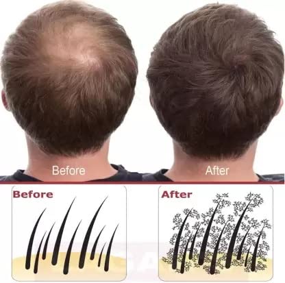 Natural Dark Brown Hair Building Fiber Powder - 25g Thickening Fibers for Hair Loss Treatment & Concealer Refill | Instant Volume Boost for Thinning Hair, Bald Spots & Receding Hairlines | Perfect for Daily Use, Special Occasions & Confidence Building