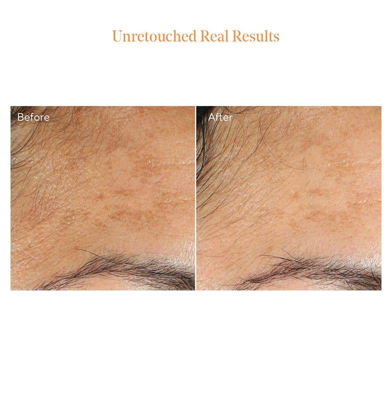 Murad Environmental Shield Vita-C Glycolic Brightening Serum - Vitamin C Face Serum for Dark Spots & Dull Skin - Brightening & Exfoliating Treatment for Glowing Skin - Perfect for Morning Skincare Routine & Anti-Aging Regimen