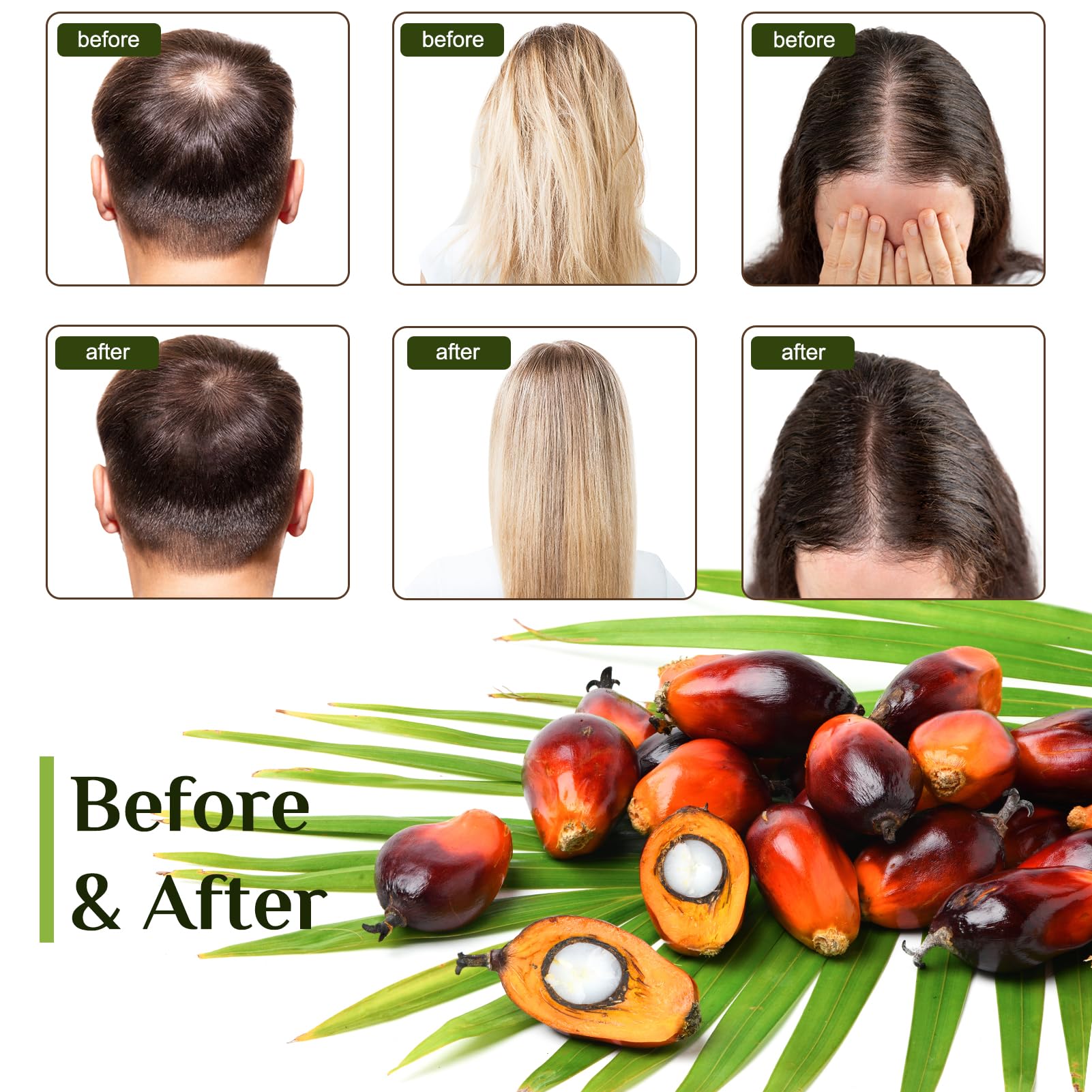 Organic Batana Oil for Hair Growth & Thickness - 100% Pure Raw Batana Oil to Prevent Hair Loss & Stimulate Growth - Dr Sebi Approved Natural Hair Treatment - 100g Bottle for Daily Scalp & Hair Care