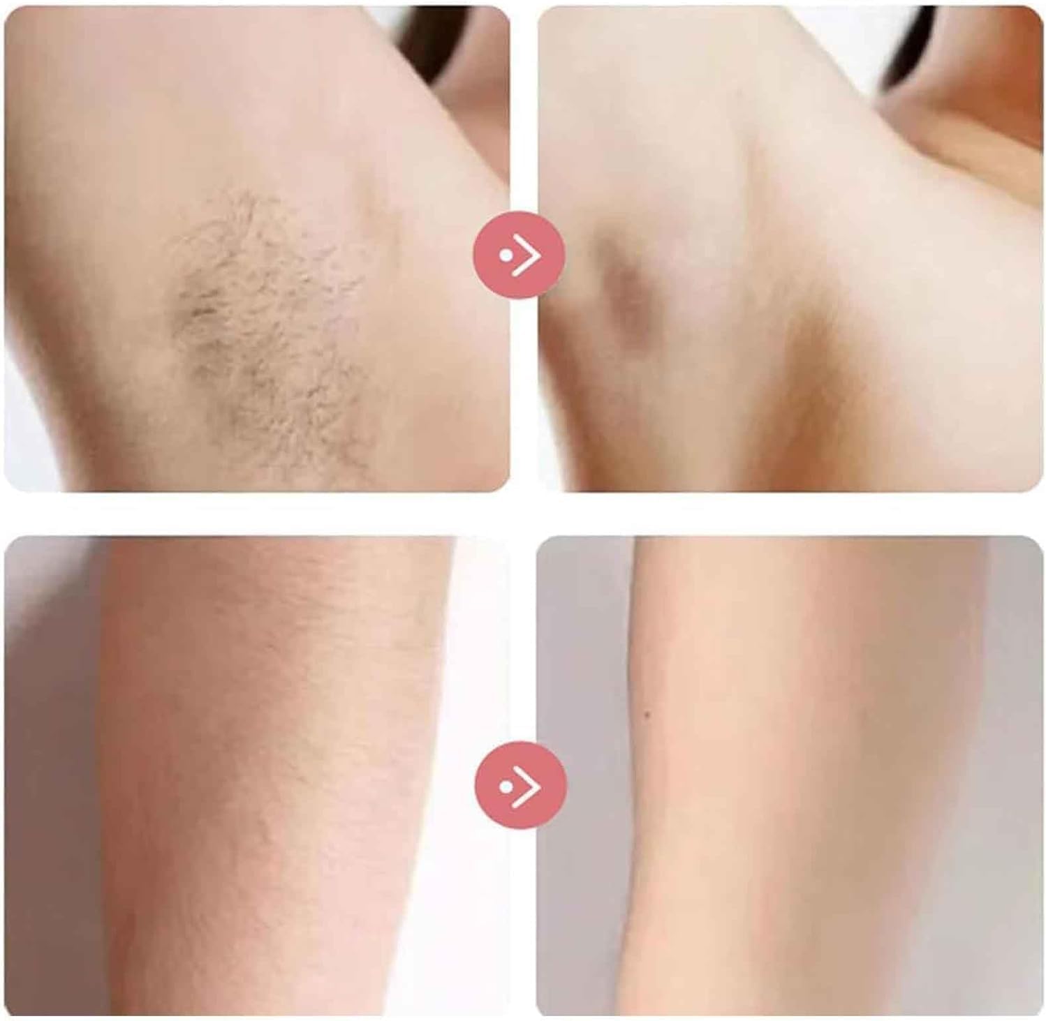 **Taletseten 4-in-1 Rechargeable Waterproof Electric Shaver for Women – Painless Hair Removal for Legs, Underarms & Bikini Area | Smooth & Comfortable Shaving at Home or Travel**