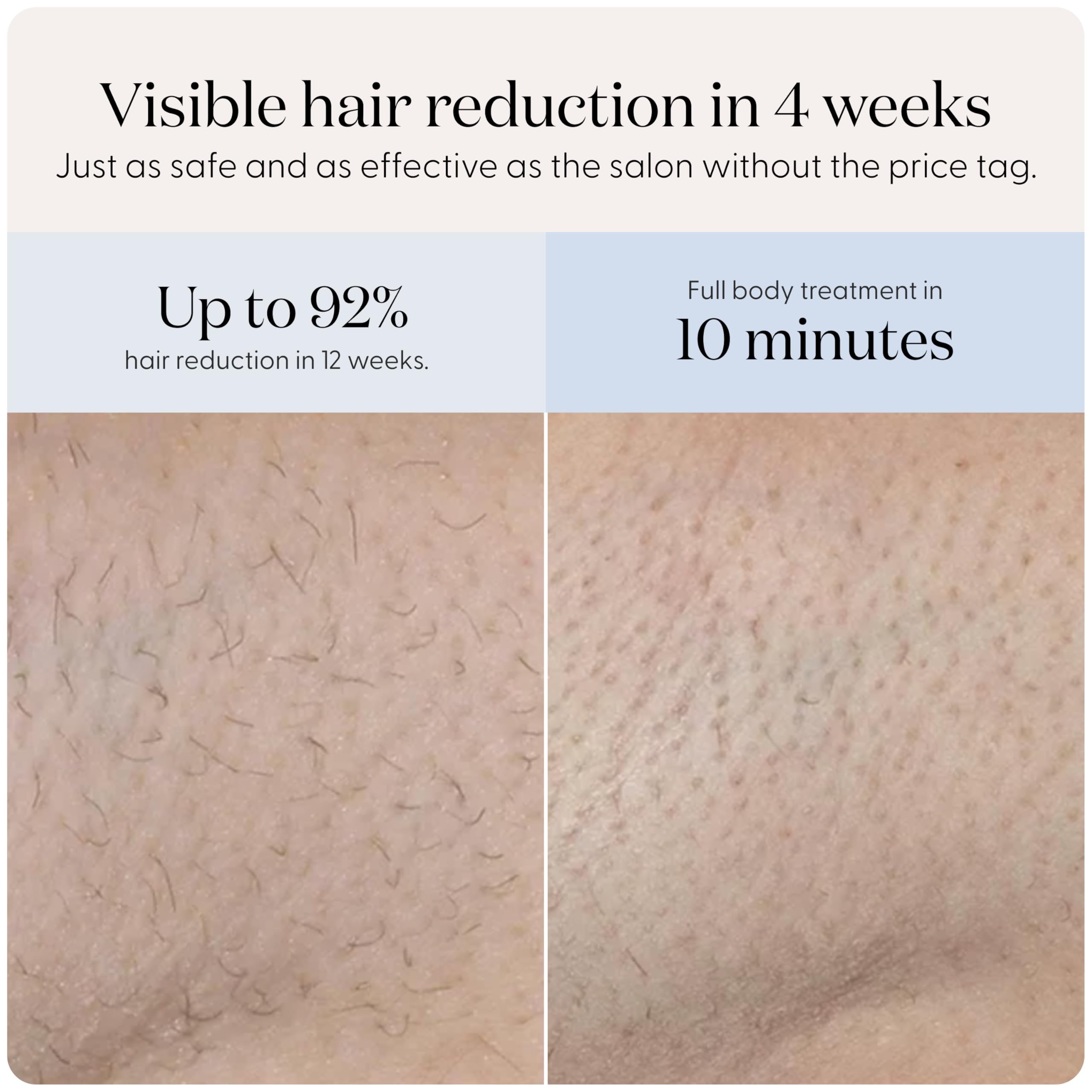 Smoothskin Pure Mini Lite Blue IPL Laser Hair Removal Device for Women & Men - Permanent Hair Removal for Body, Face, Bikini Line - Painless At-Home Hair Remover Alternative to Salon Laser Treatments - Perfect for Travel & Quick Touch-Ups