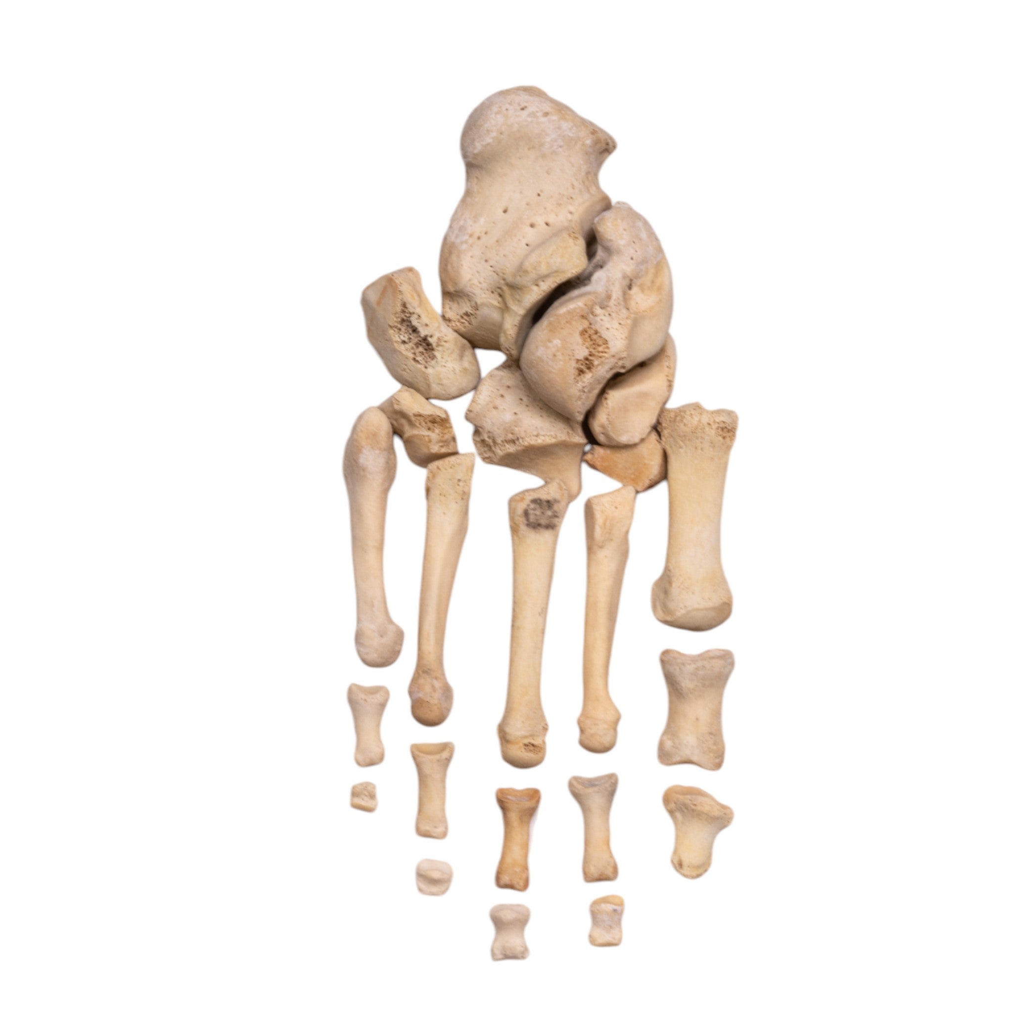 Authentic Real Human Foot Partial Set for Medical Education & Anatomy Study - Perfect for Doctors, Students & Researchers