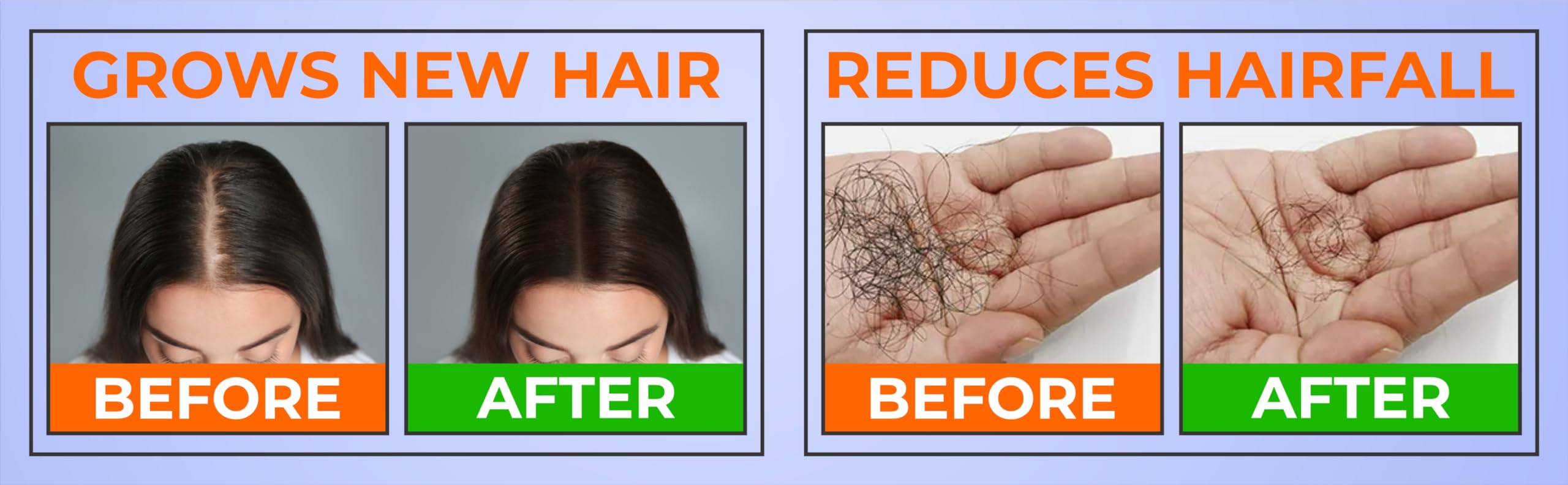 VOSCURE Natural Handmade Hair Oil with 25+ Herbs for Men & Women | Controls Dandruff & Hair Fall, Promotes Hair Growth & Thickness | Herbal Treatment for Dry, Damaged Hair | 100ml | Perfect for Daily Scalp Massage & Hair Care Routine