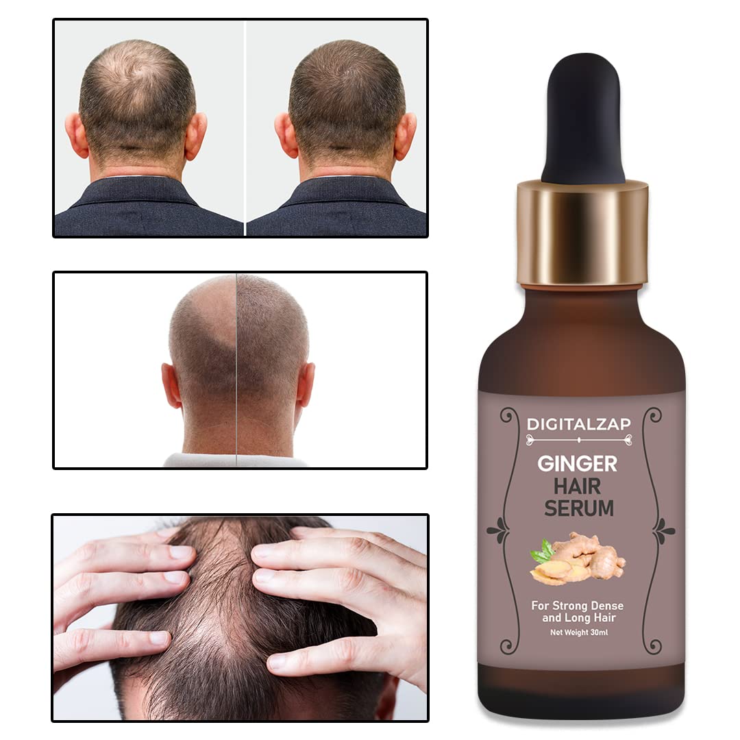 Ginger Root Hair Growth Serum for Men & Women - Strengthening & Nourishing Treatment for Thinning Hair & Hair Loss (3-Pack, 30ml) - Perfect for Daily Scalp Care & Healthy Hair Regrowth