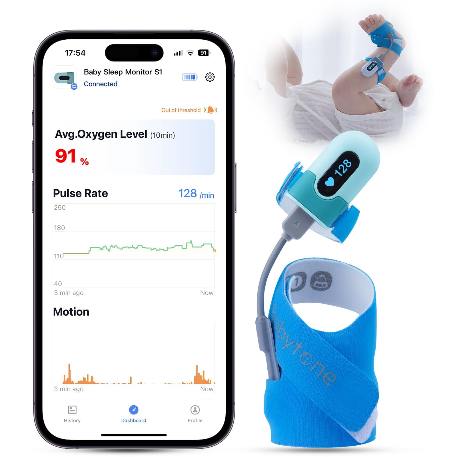 Babytone Baby Oxygen Monitor & Smart Sleep Sock - Wearable Infant Foot Monitor with Bluetooth & App - Tracks O2 Levels, Pulse Rate & Movement for Newborns 0-36 Months - Perfect for Nighttime Sleep Monitoring & Peace of Mind for Parents