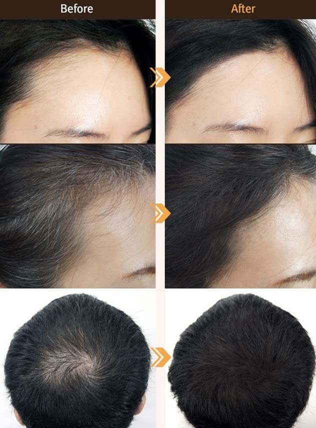 Natural Hairline Filler Powder & Hair Shadow Cushion - Forehead Makeup for Thinning Hair (Brown) | Instant Root Cover-Up & Scalp Concealer for Bald Spots, Receding Hairlines & Hair Loss - Perfect for Daily Use, Special Occasions & Confidence Boosting