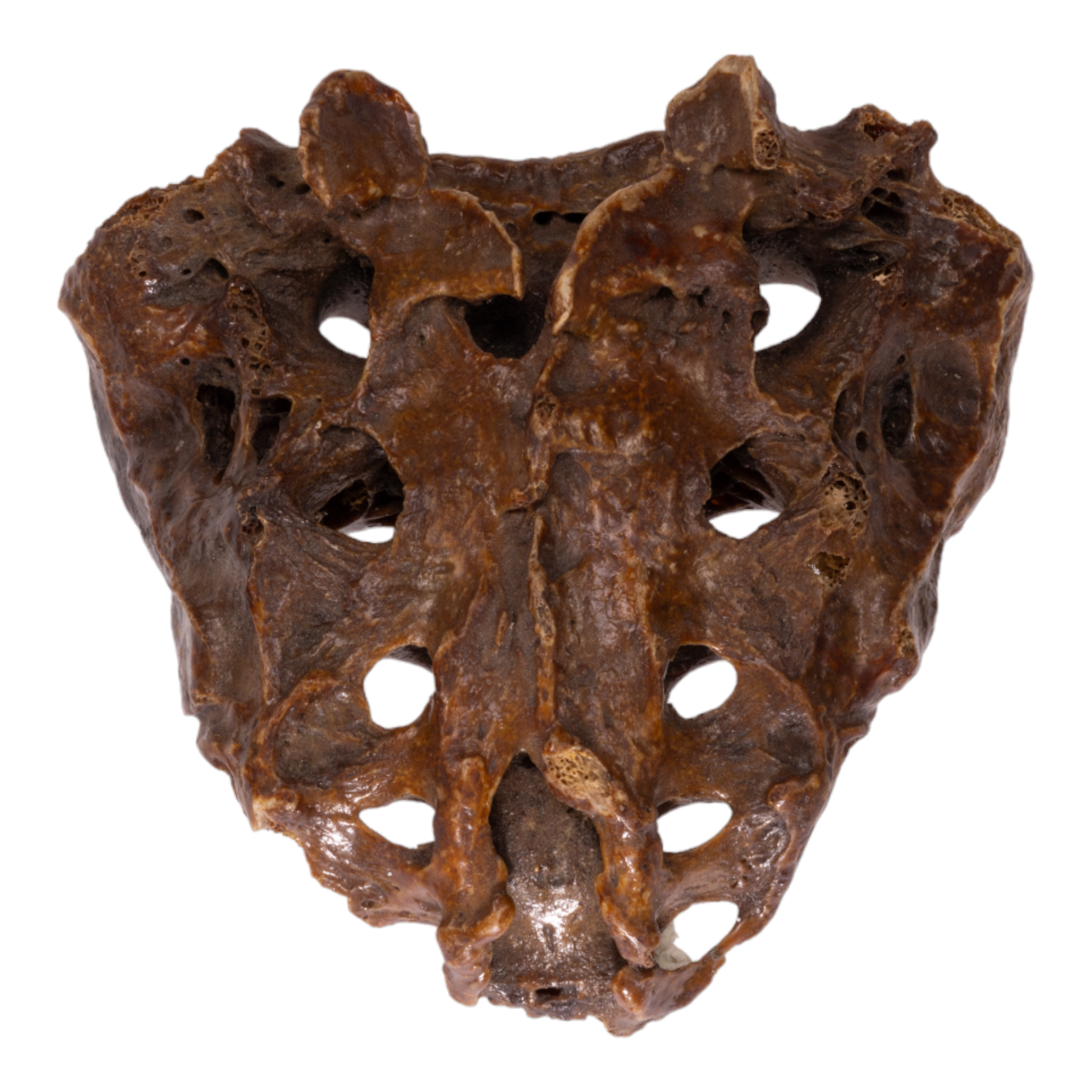 Antique Real Human Sacrum Bone - Medical Specimen, Anatomy Study, Gothic Decor, Halloween Prop