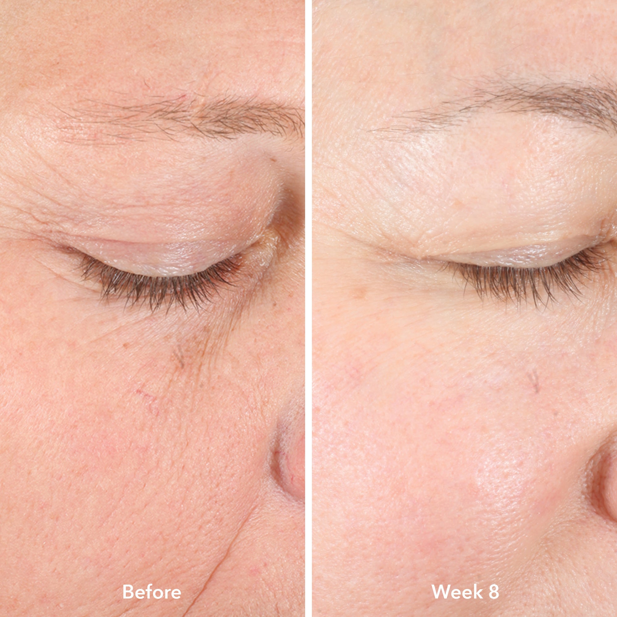 Best Collagen Booster Serum with Electric Daisy & Peptides - Anti-Aging Firming Face Treatment for Wrinkles & Fine Lines - Perfect for Night Skincare Routine & Daily Hydration