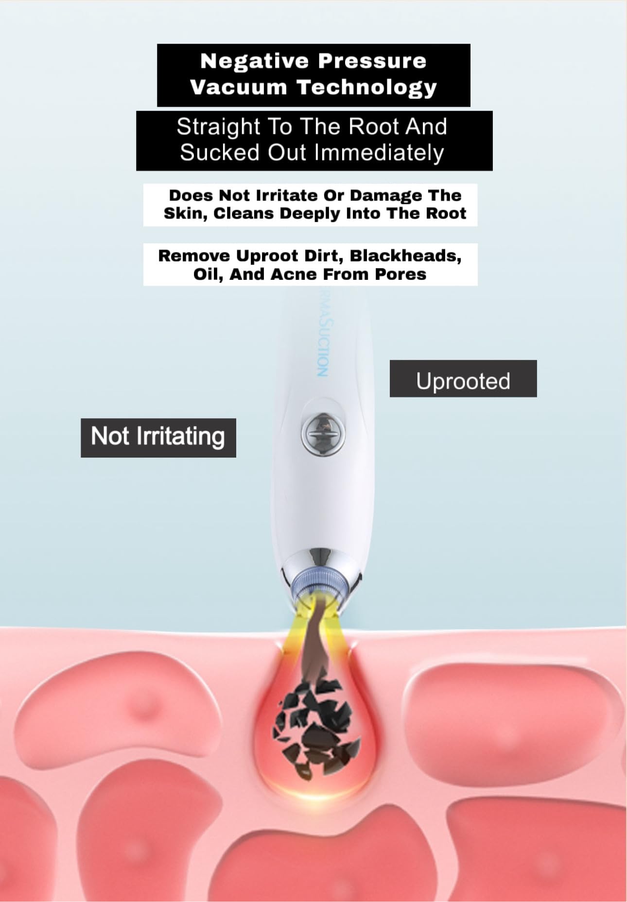 BINSBARRY 4-in-1 Blackhead & Whitehead Remover Tool - Professional Pimple Extractor, Acne Treatment & Pore Vacuum Cleaner for Face Care - Skin Care Device for Men & Women (White) - Perfect for Home Spa & Daily Skincare Routine
