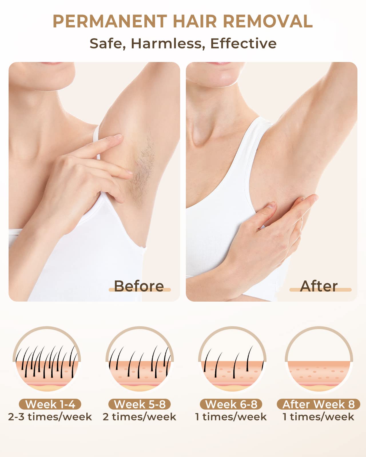 ZKMAGIC IPL Hair Removal Device for Women & Men - 3-in-1 Laser Hair Remover with HR/SC/RA Modes, 9 Adjustable Energy Levels & 999,900 Flashes - Permanent Hair Removal for Face, Legs, Arms, Bikini Line & Whole Body - At-Home Salon Treatment for Smooth Skin