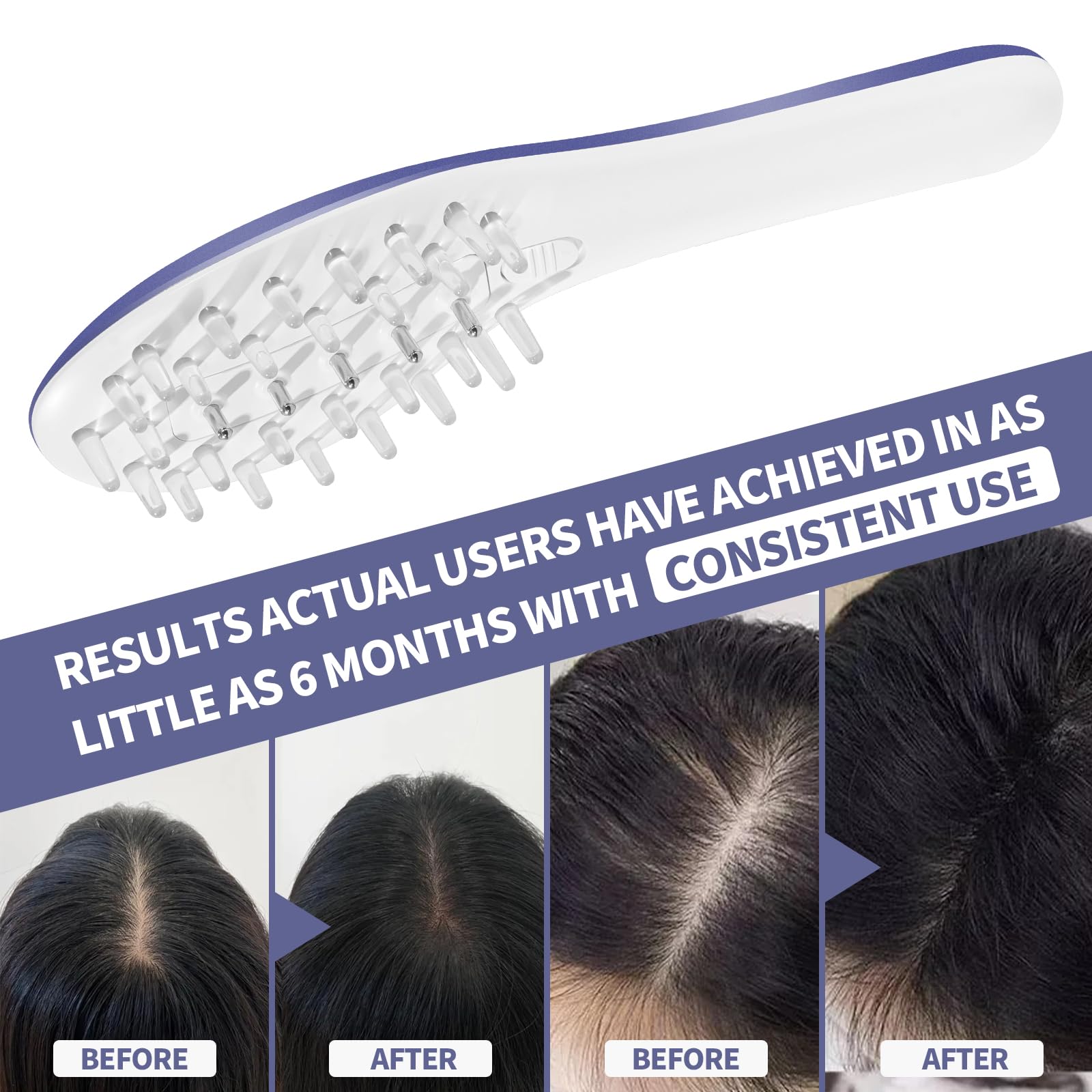 Laser Hair Growth Comb for Women & Men - Electric Scalp Massager with Laser Therapy Technology to Stimulate Hair Regrowth | At-Home Hair Care Device for Thinning Hair & Scalp Health