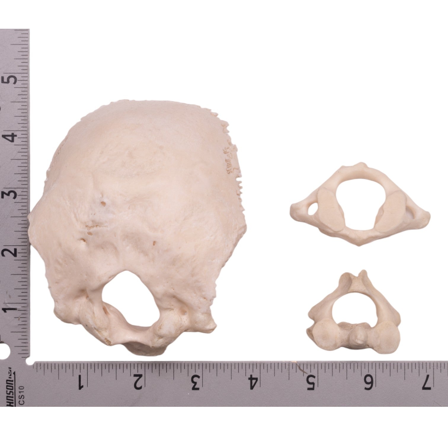 Authentic Human Occipital Bone, Atlas & Axis Vertebrae Set - Medical Study, Anatomy Education & Forensic Research