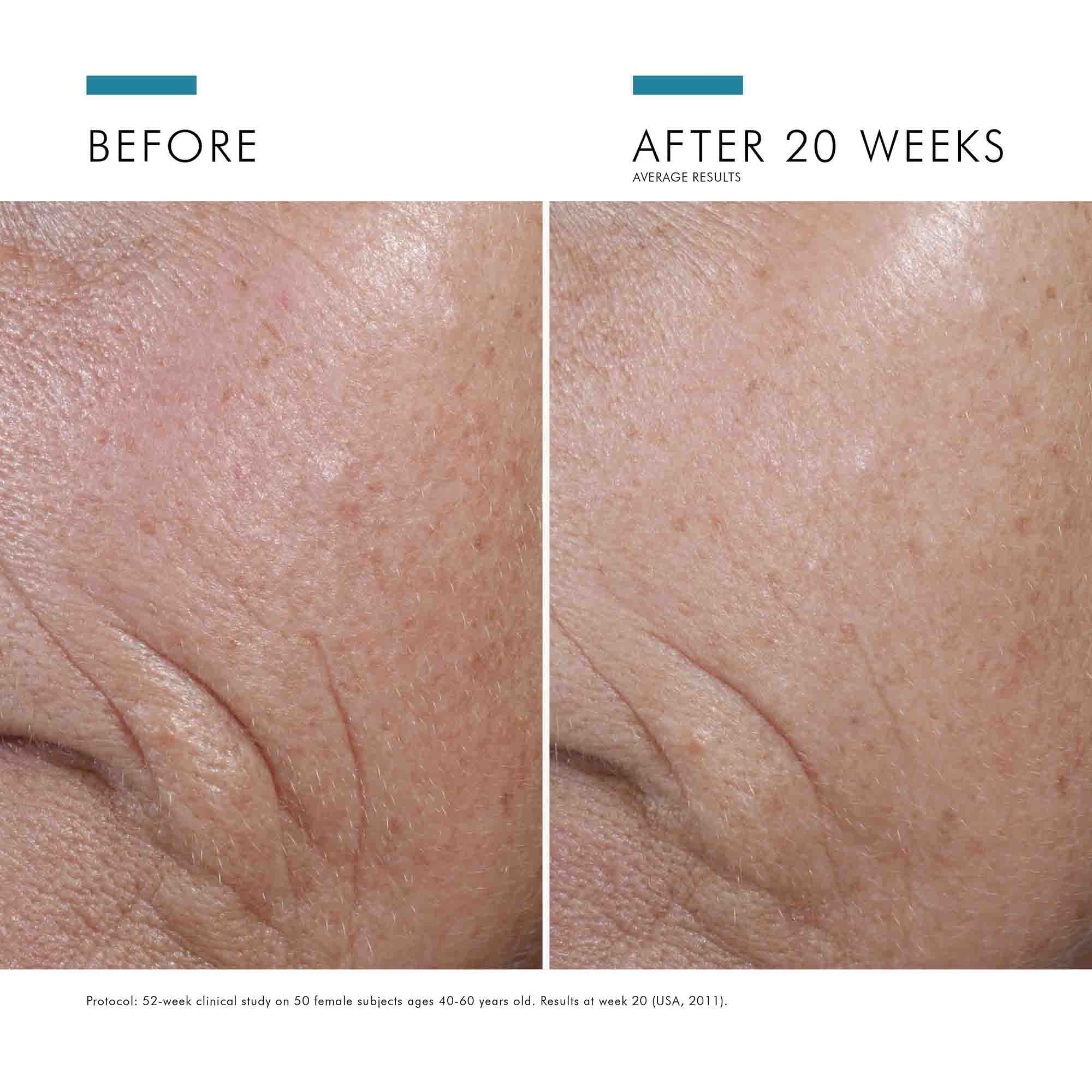 Skinceuticals C E Ferulic Serum - Vitamin C Antioxidant Face Treatment for Brightening & Anti-Aging - Perfect for Daily Skincare Routine & Sun Protection