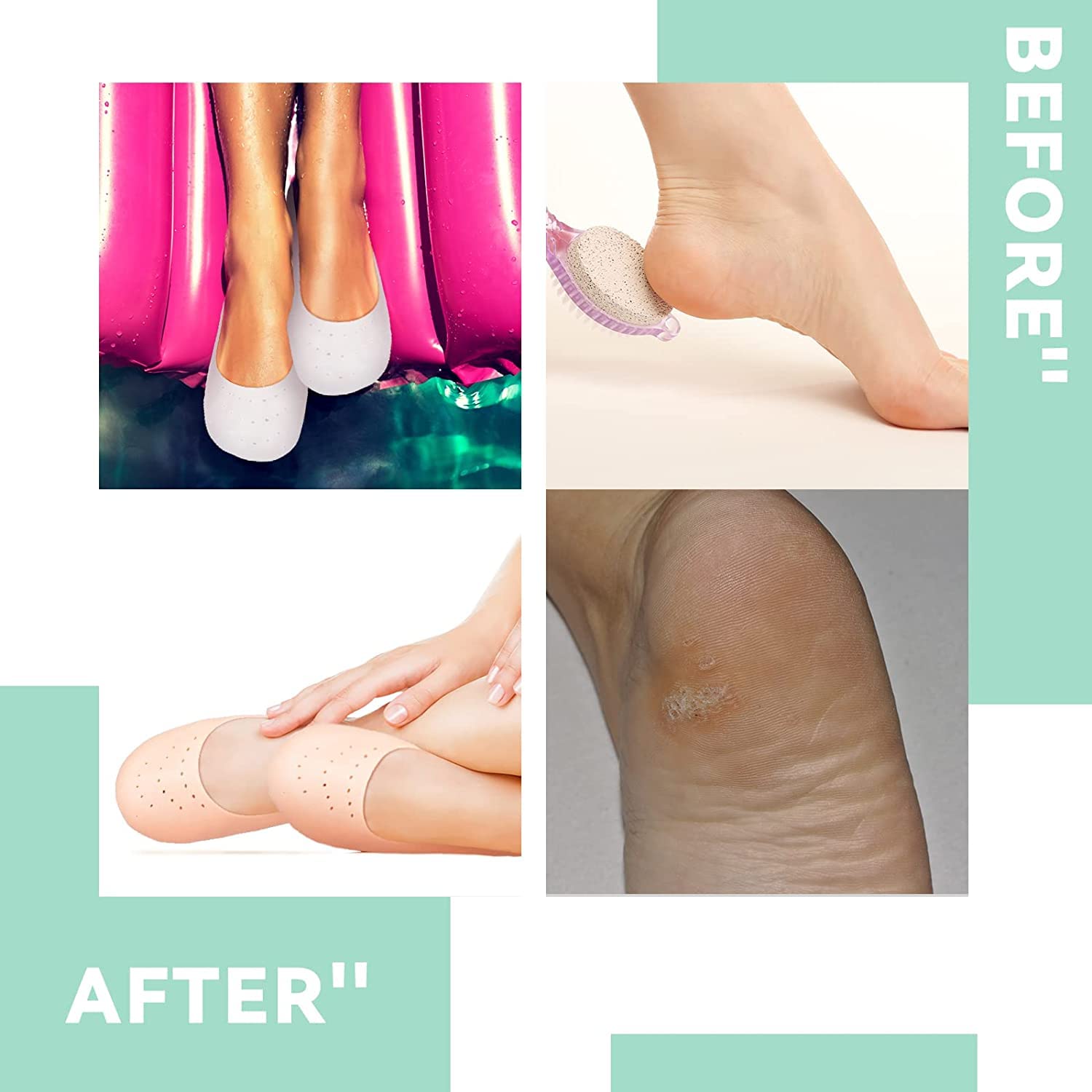 Shemok 1 Pair Aloe Vera Silicone Moisturizing Socks - Anti-Slip Breathable Gel Heel Protectors for Dry Cracked Feet - Softening Foot Care for Women & Men - Perfect for Overnight Foot Spa & Pedicure Treatment