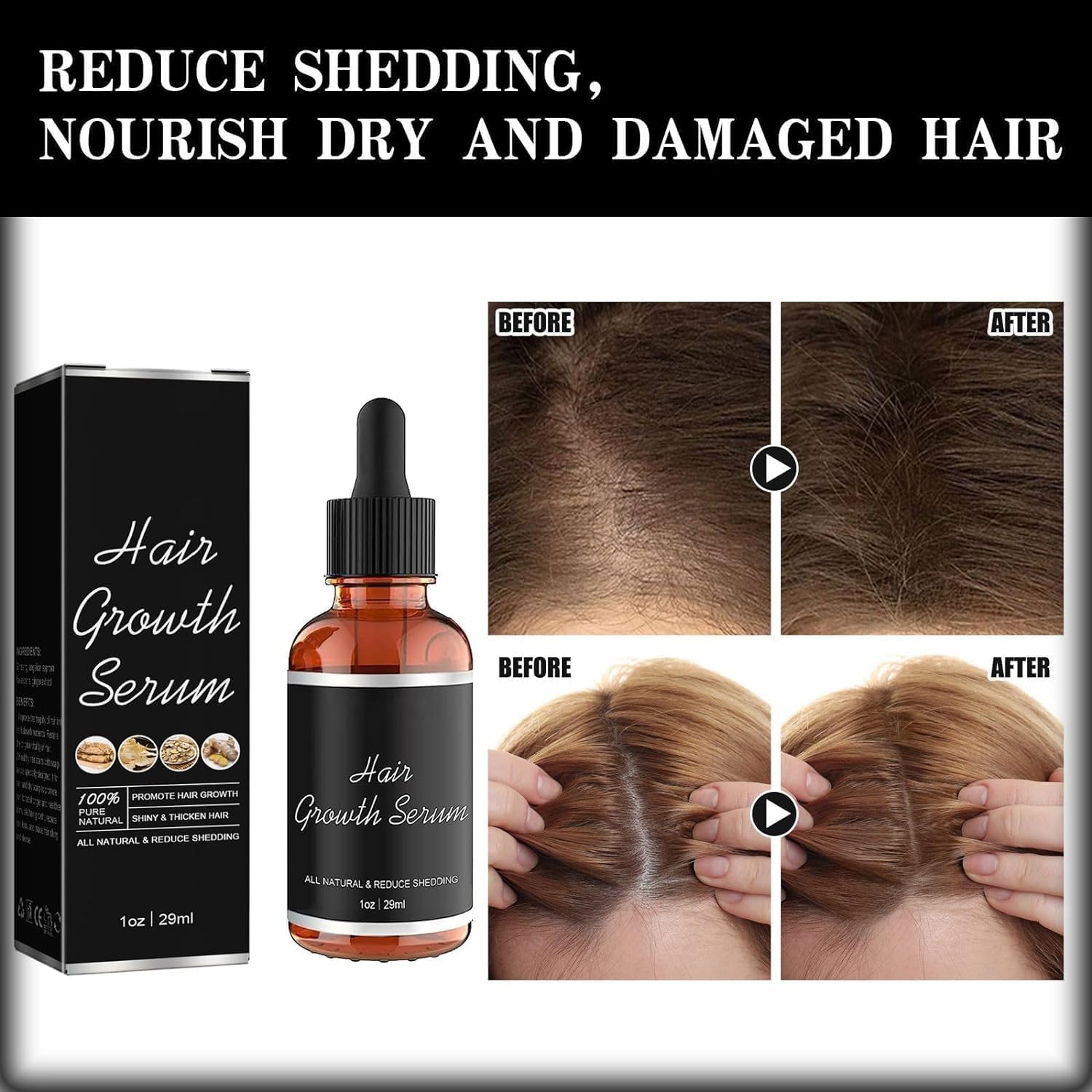 Renora Hair Growth Serum for Black Women - 29ml Anti Hair Loss Treatment, Nourishes Dry & Damaged Hair, Promotes Thicker & Healthier Locks (3 Pack) - Perfect for Daily Scalp Care & Natural Hair Regrowth Routine