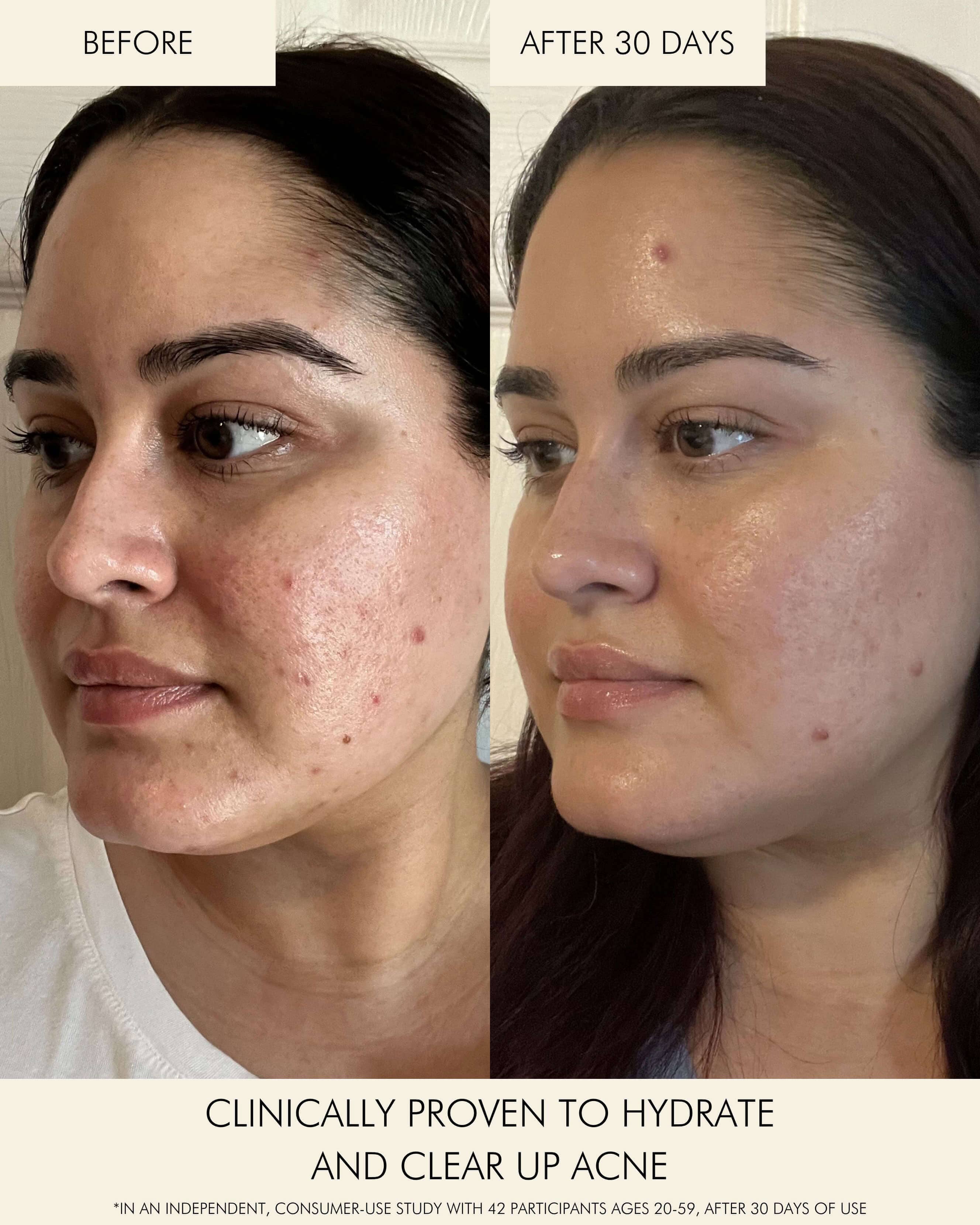 Niacinamide + Copper Clear Skin Mineral Milk - Brightening & Hydrating Face Serum for Acne & Dark Spots | Perfect for Daily Skincare Routine & Nighttime Use
