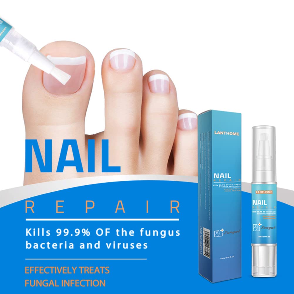 Ofanyia Anti-Fungal Nail Treatment Pen for Toenail & Fingernail Fungus Repair - Strengthens Brittle Nails & Promotes Healthy Growth - Effective Nail Care Solution for Athletes, Swimmers & Daily Use