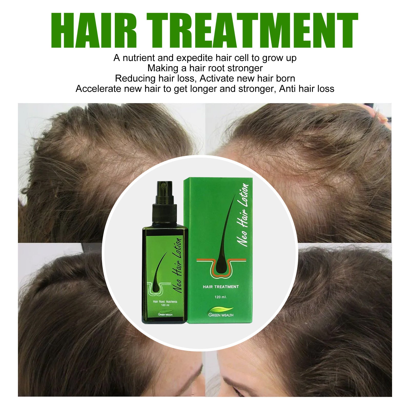 Hair Growth Lotion Spray for Thicker, Longer Hair - Nourishing Treatment for Hair Loss Prevention & Scalp Care - Perfect for Daily Use at Home or Salon