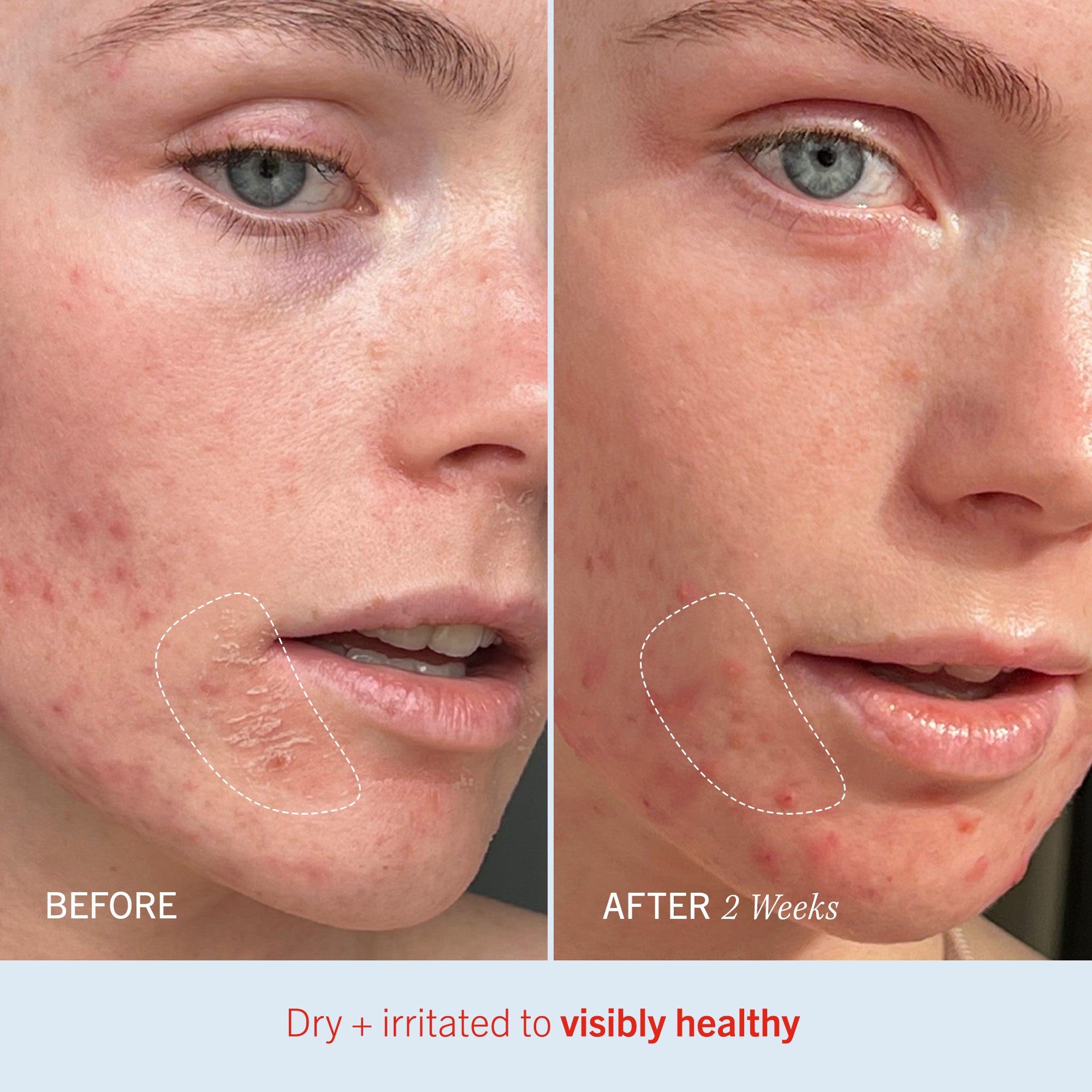 Best Dry Skin Duo Set for Hydration & Repair - Moisturizing Cream & Serum for Face & Body - Perfect for Winter & Sensitive Skin Care
