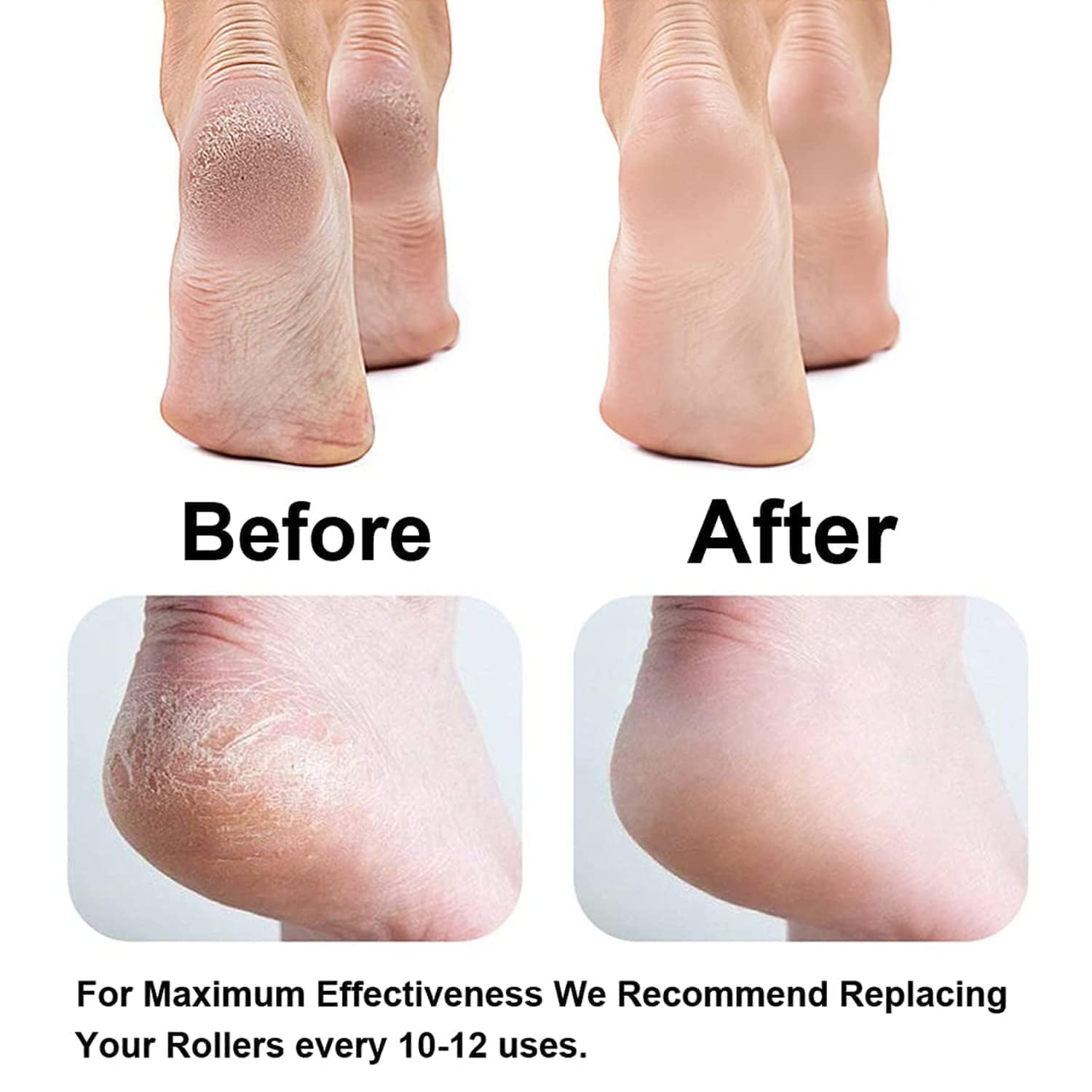 GOPAD Electric Foot Callus Remover - Professional Pedicure Machine for Hard Cracked Skin & Dead Skin Removal - Rechargeable Foot Scrubber Roller with Spin Technology - Home Spa Pedi Care (Multicolor) - Perfect for At-Home Foot Care & Relaxation After Workouts