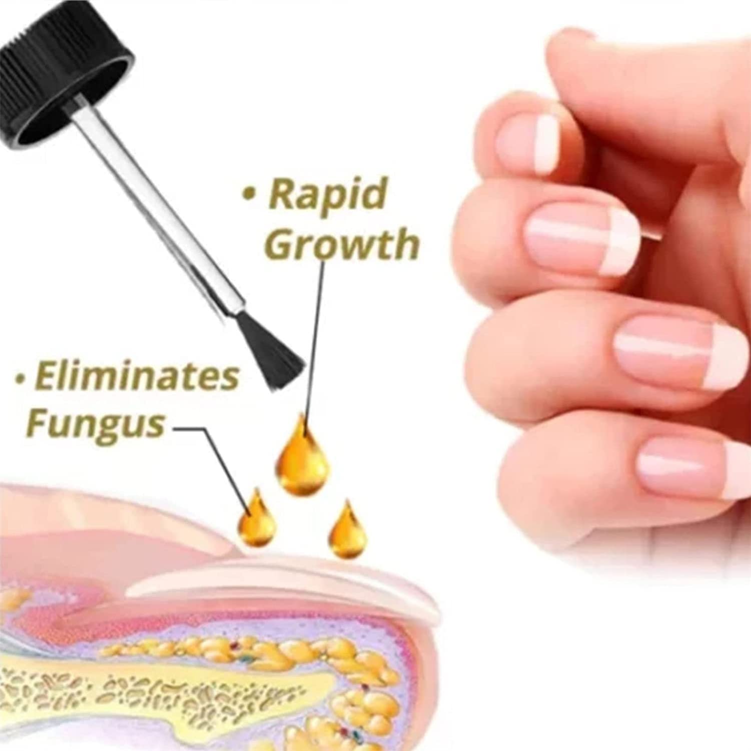 NailGro Intense Nail Growth & Strengthening Serum - Fast-Acting Nail Repair Treatment for Stronger Nails in 7 Days - Perfect for Weak, Brittle Nails & Nail Care Routine (1PC)